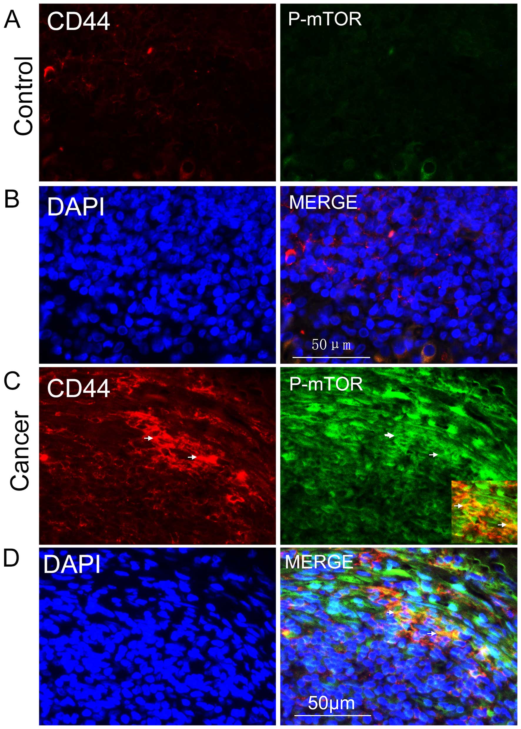 Downregulation of cancer stem cell properties via mTOR 