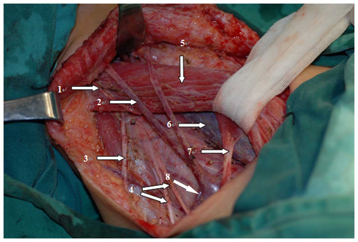 Application of a cervical low incision in the functional neck