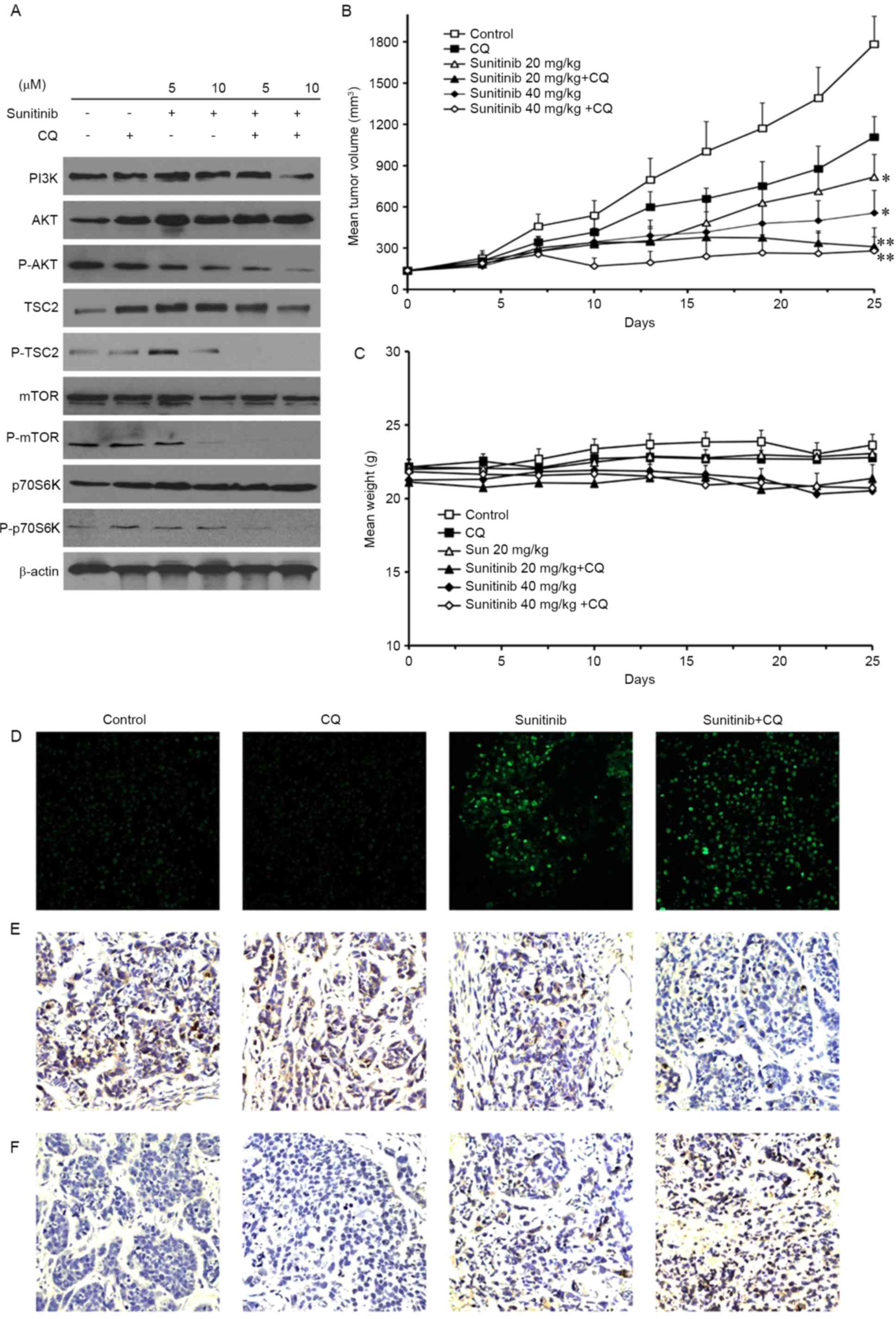 (PDF) Chloroquine potentiates the anticancer effect of 