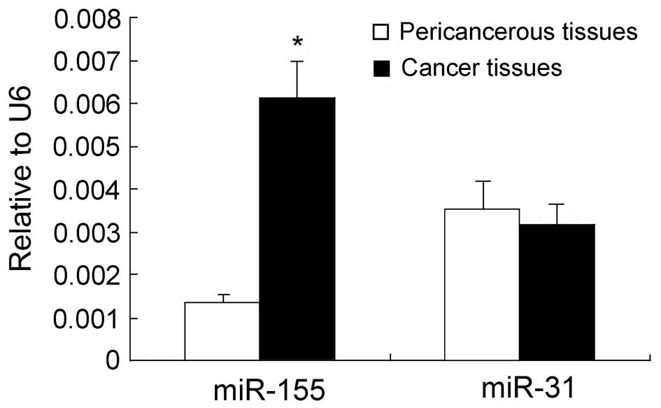 Mir 155 And Mir 31 Are Differentially Expressed In Breast Cancer