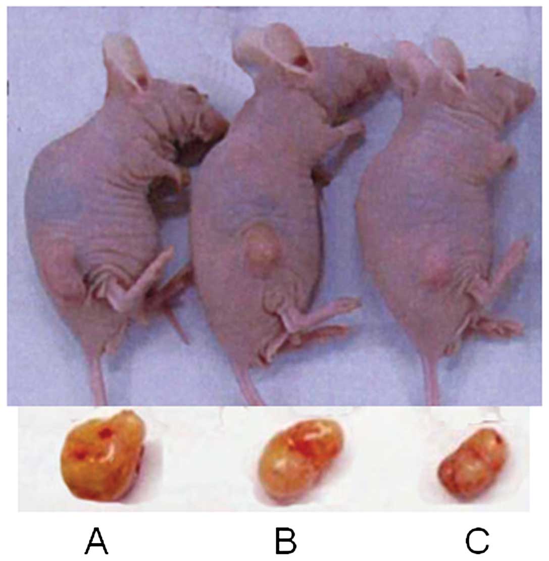 Chidamide, a histone deacetylase inhibitor, functions as a tumor