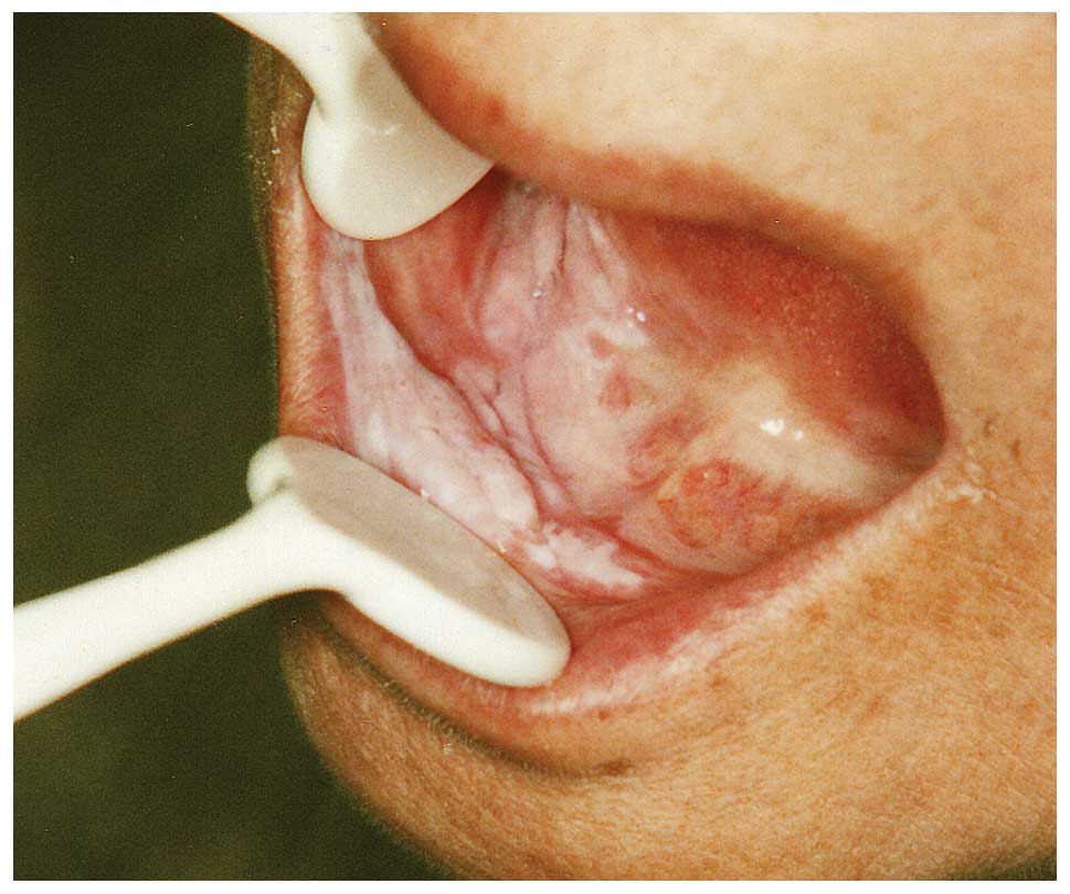 Vagina Oral 58