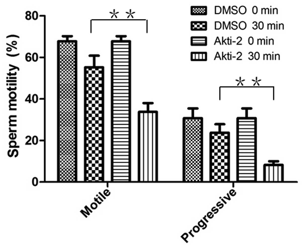 Sperm Motility