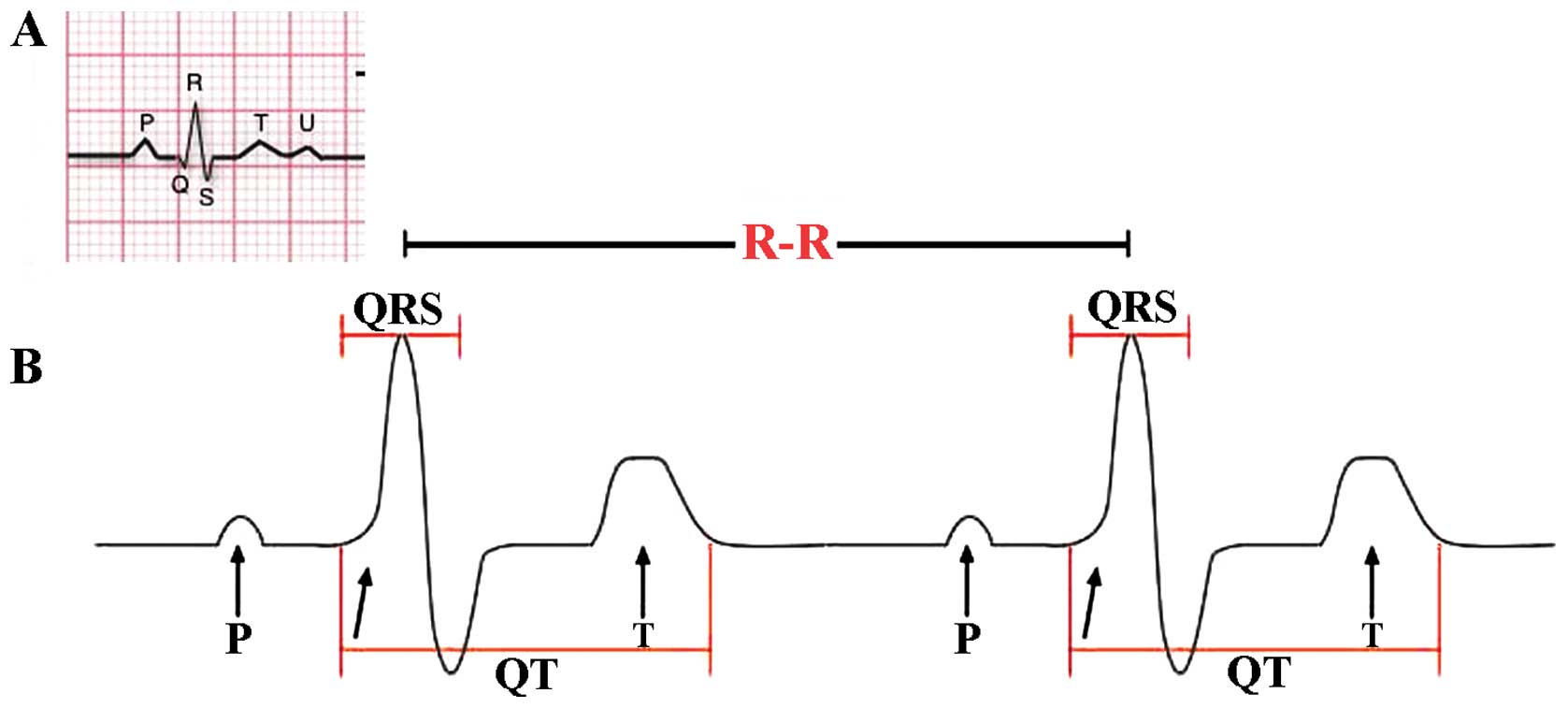 Recovery Heart Rate Chart Pdf