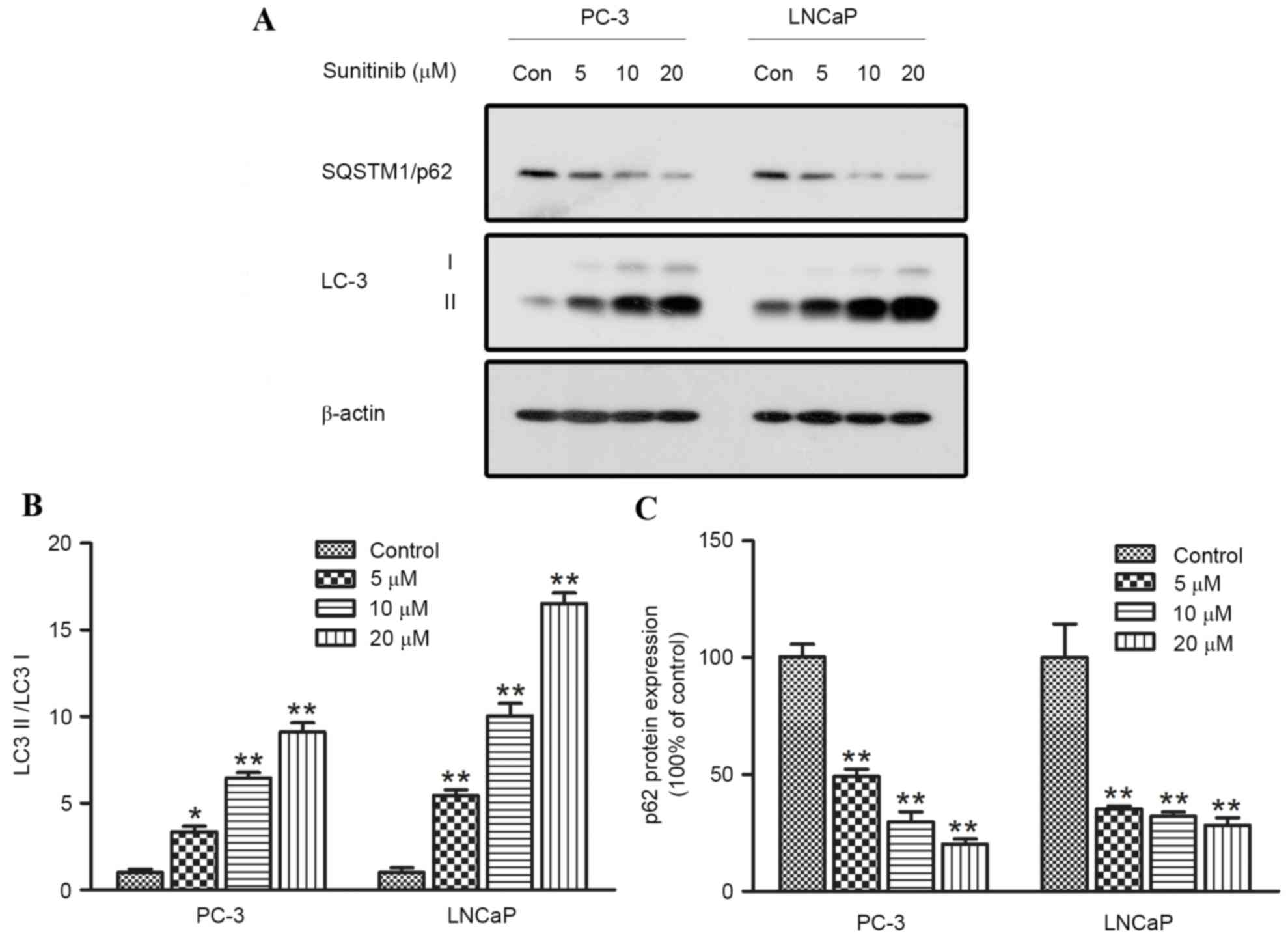Chloroquine inhibits hepatocellular carcinoma cell growth 