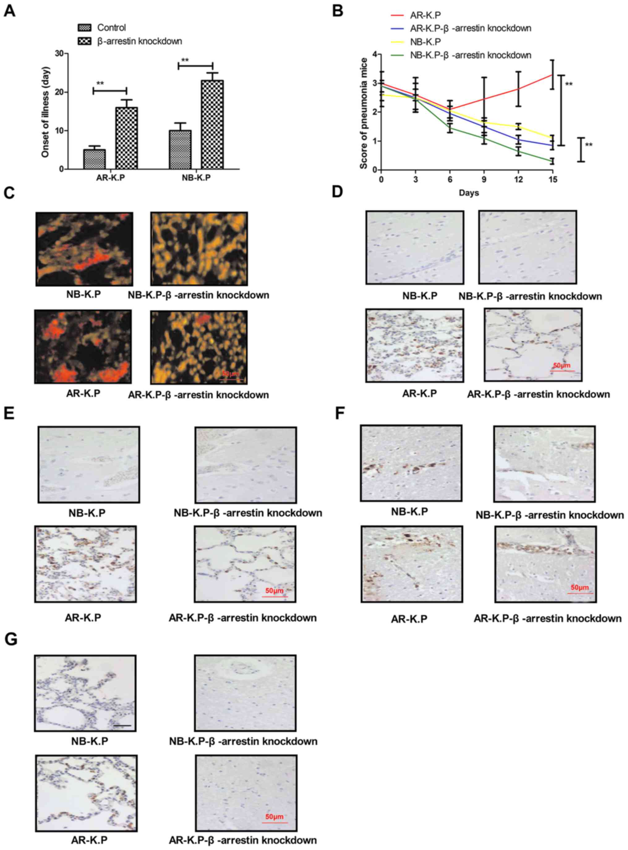 Antibiotic Resistance Of Klebsiella Pneumoniae Through β - 