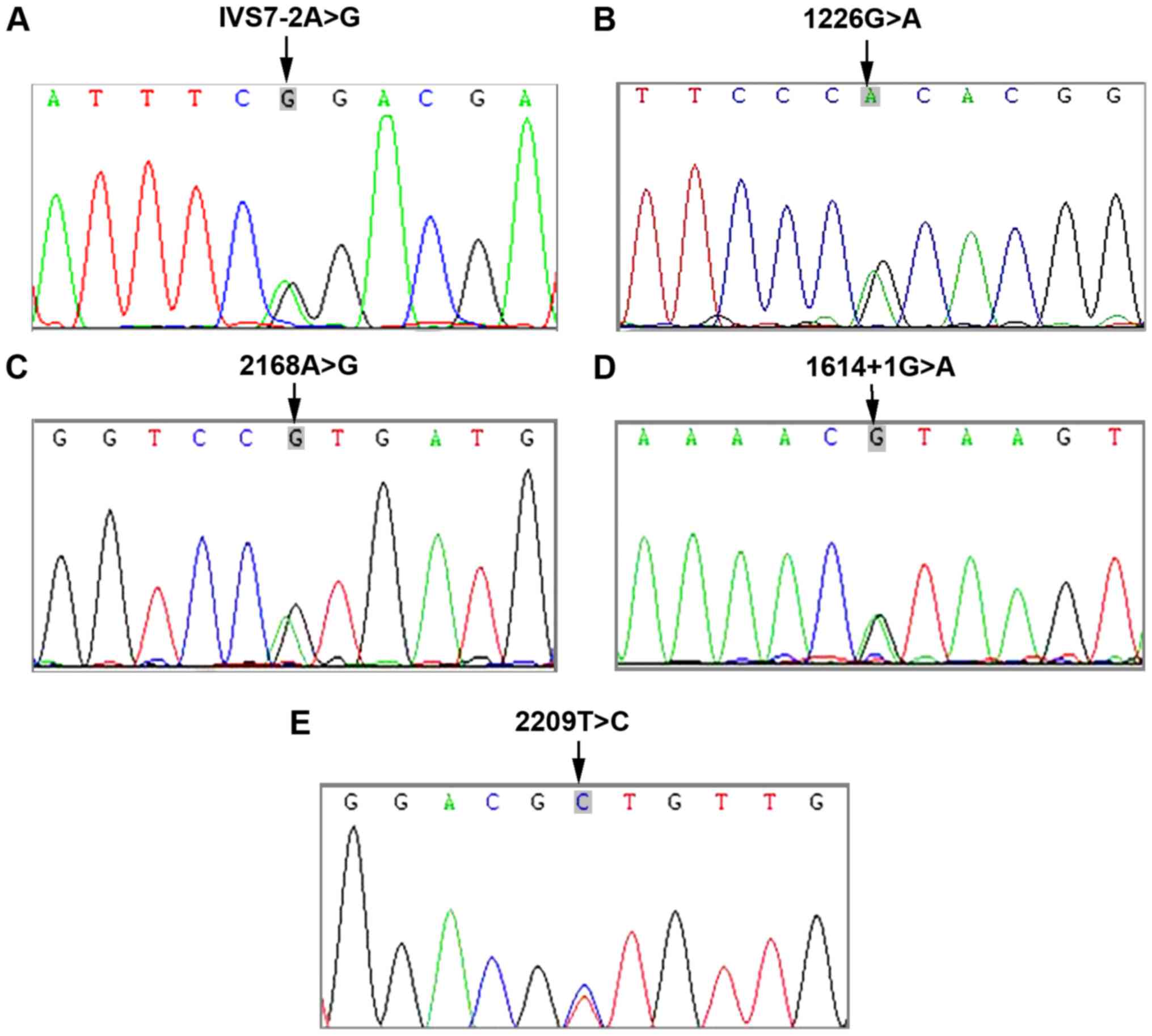 Dostum Satın alma yer fıstığı  Gene mutation analysis and genetic counseling for patients with  non‑syndromic hearing loss in Linyi region