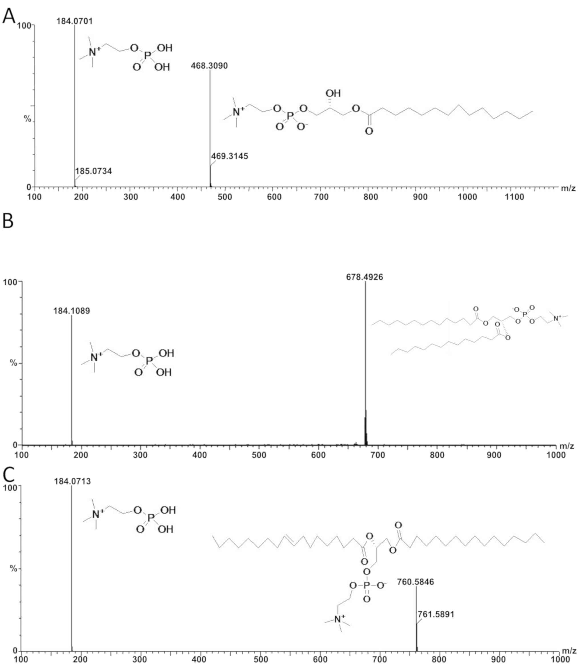 Typical BPI of feces samples in positive ESI mode. (A) Control group;