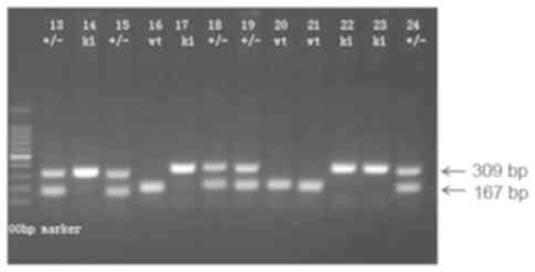 Mechanism Of H2s Mediated Rock Inhibition Of Total Flavones Of Rhododendra Against Myocardial Ischemia Injury