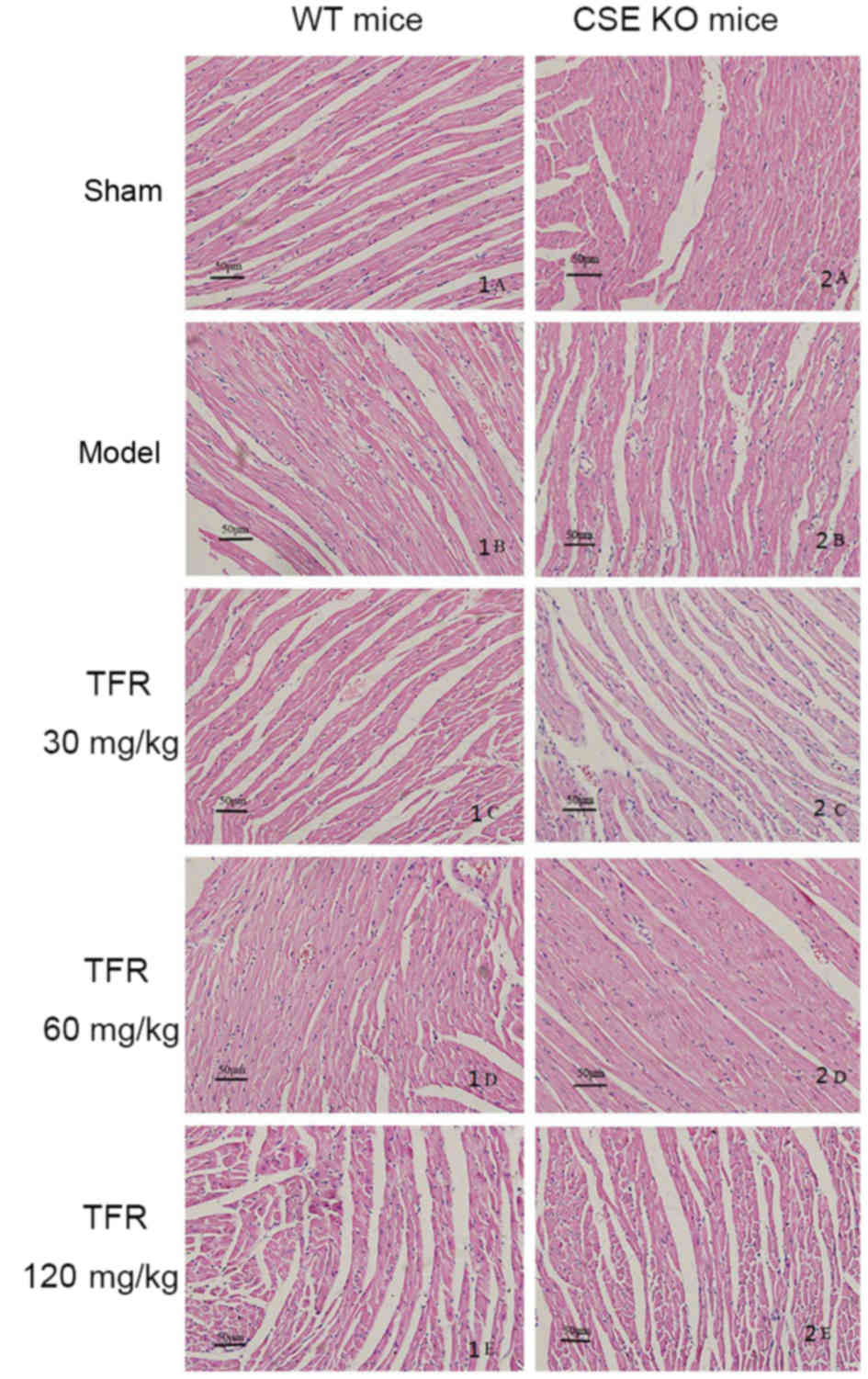 Mechanism Of H2s Mediated Rock Inhibition Of Total Flavones Of Rhododendra Against Myocardial Ischemia Injury