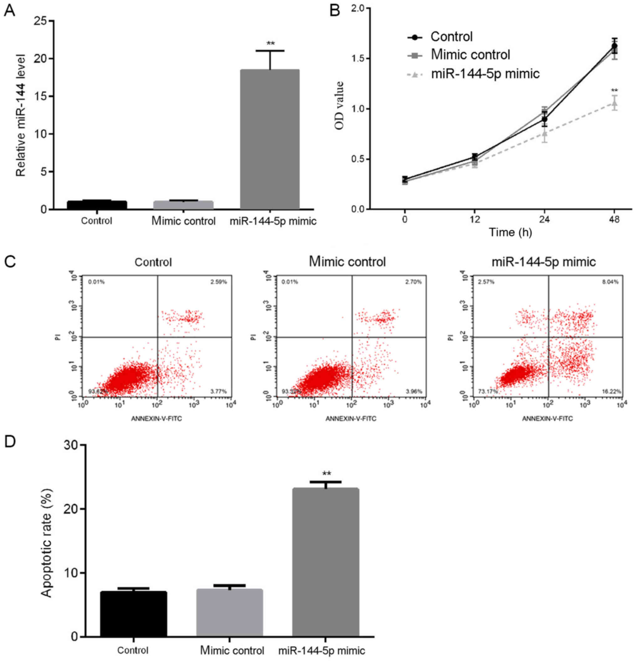 Effect Of Microrna‑144‑5p On The Proliferation Invasion And Migration Of Human Umbilical Vein