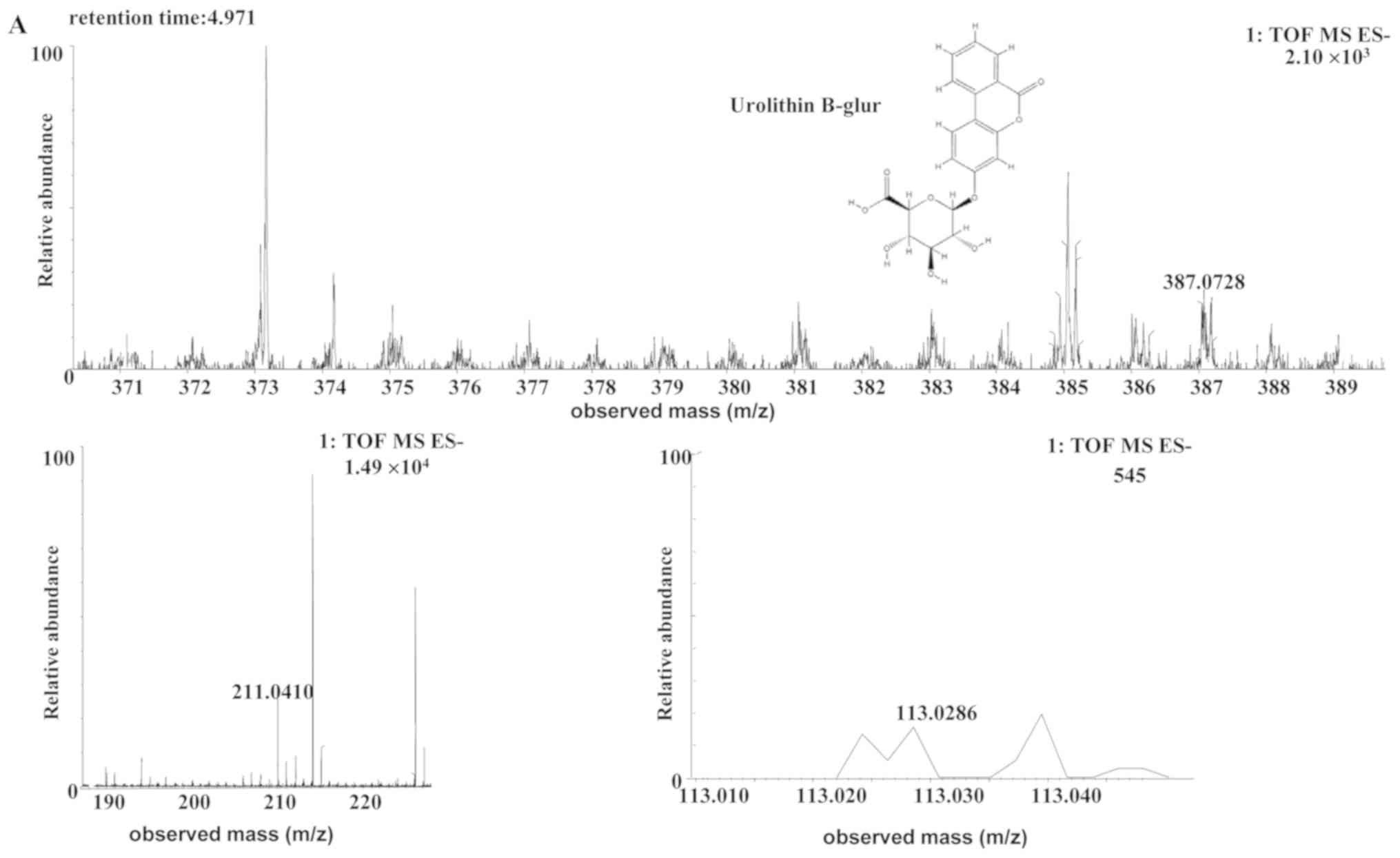 Typical BPI of feces samples in positive ESI mode. (A) Control group;