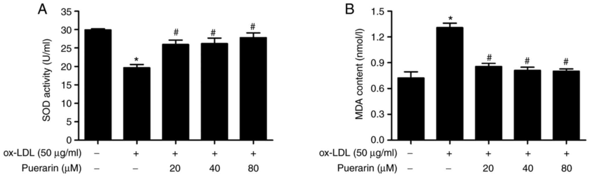Puerarin Protects Vascular Smooth Muscle Cells From Oxidized Low Density Lipoprotein Induced Reductions In Viability Via Inhibition Of The P38 Mapk And Jnk Signaling Pathways