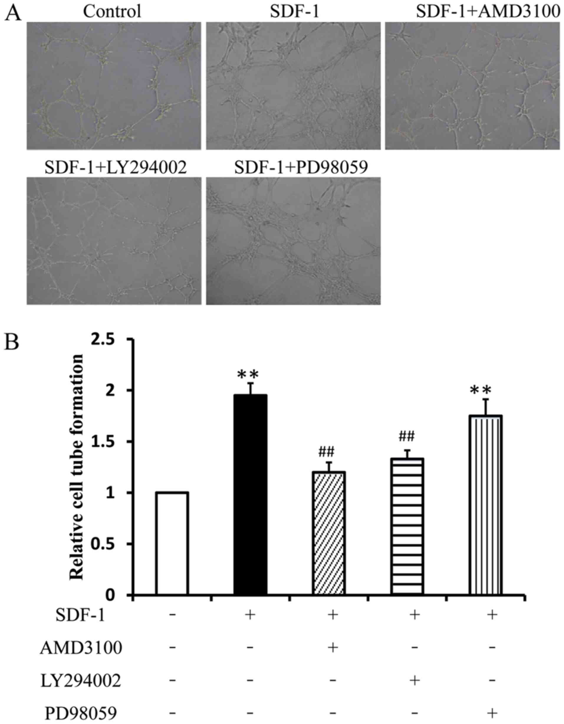 Role Of The Stromal Cell Derived Factor 1 In The Biological Functions Of Endothelial Progenitor Cells And Its Underlying Mechanisms
