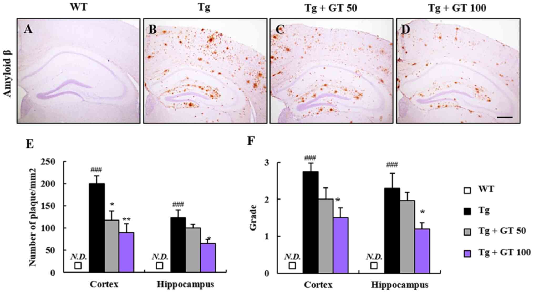 Ginseng Gintonin Attenuates The Disruptions Of Brain Microvascular Permeability And Microvascular Endothelium Junctional Proteins In An Appswe Psen 1 Double Transgenic Mouse Model Of Alzheimer S Disease