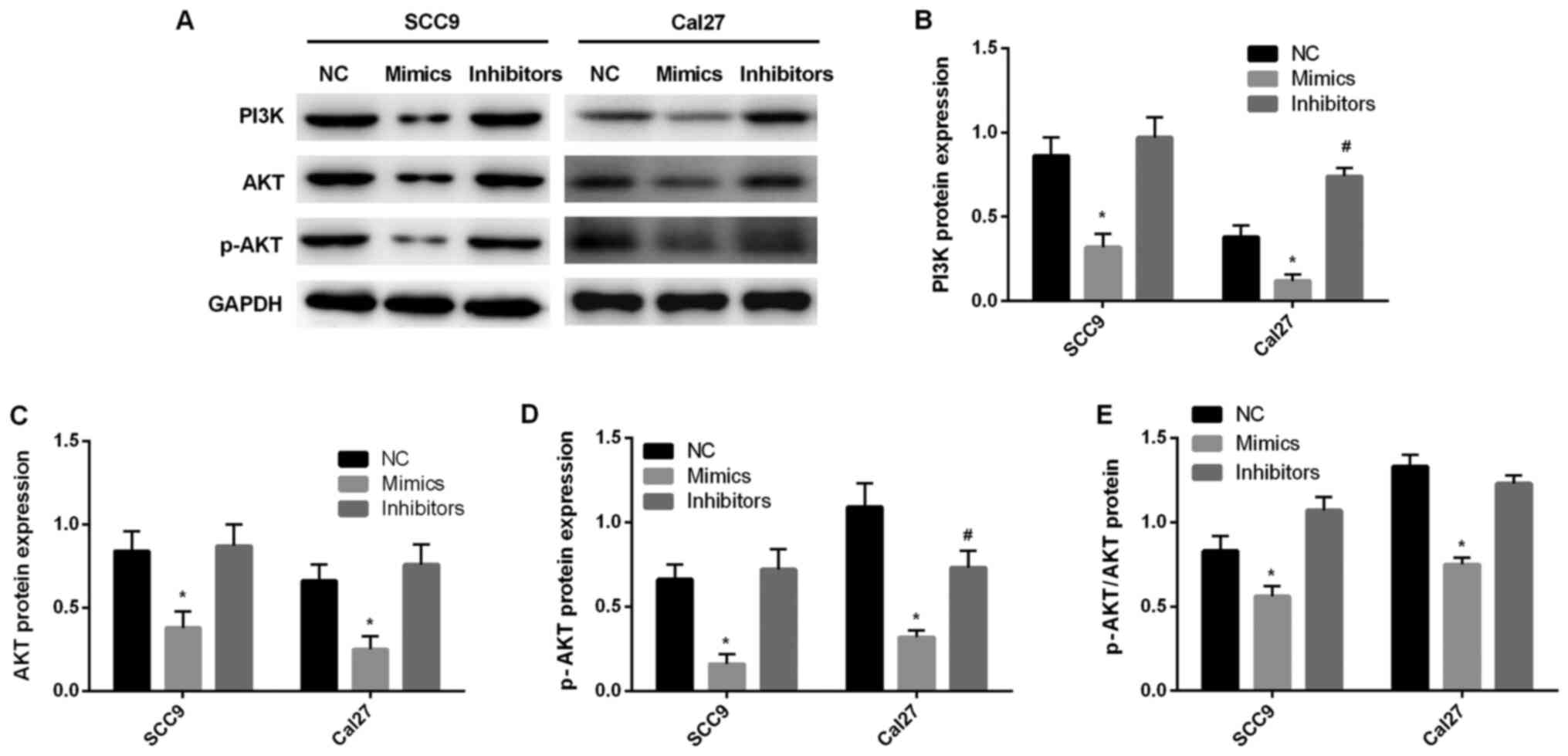 MicroRNA-145-5p aggravates cell apoptosis and oxidative stress in 