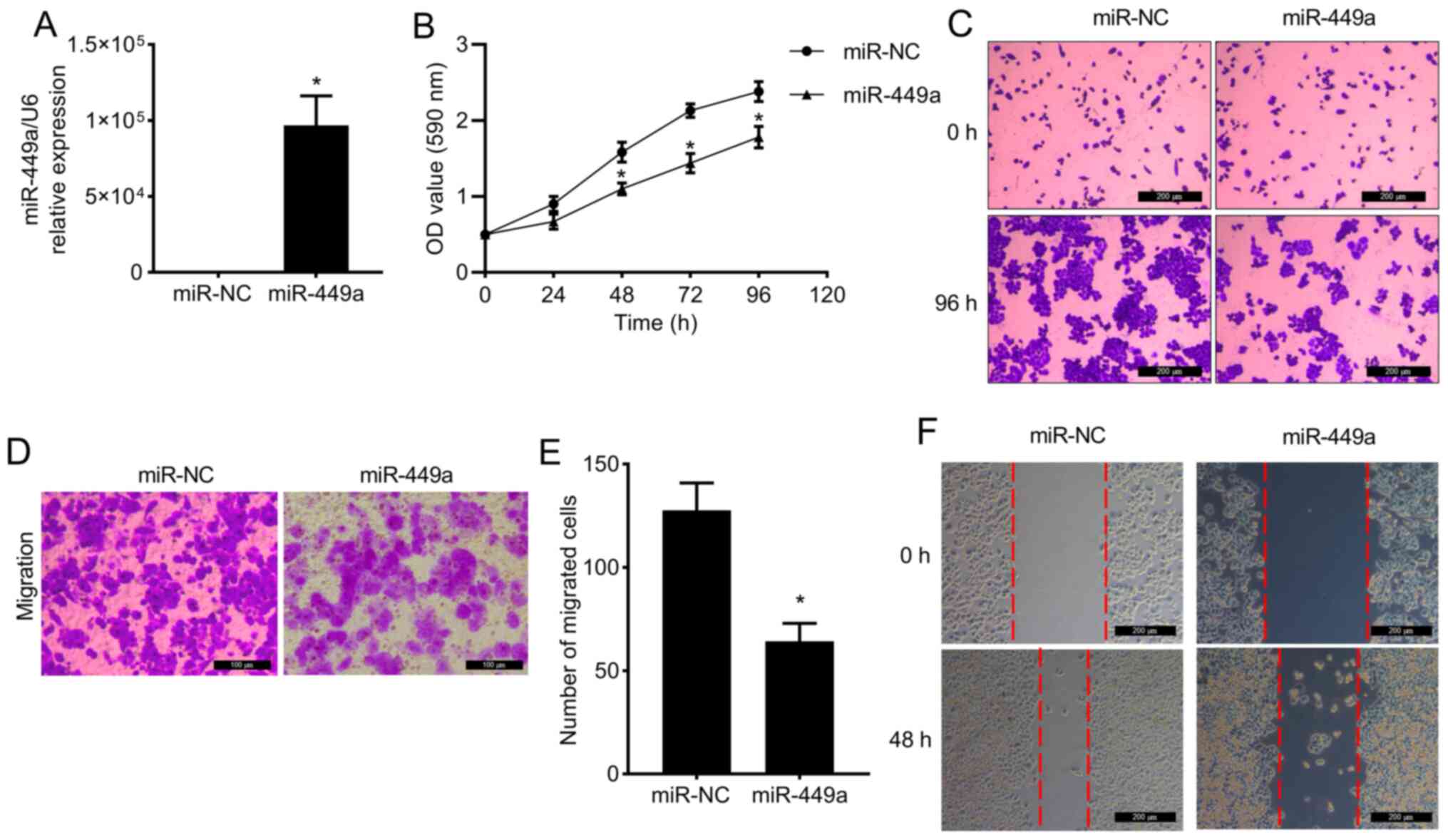 Microrna‑449a Inhibits Cell Proliferation And Migration By Regulating