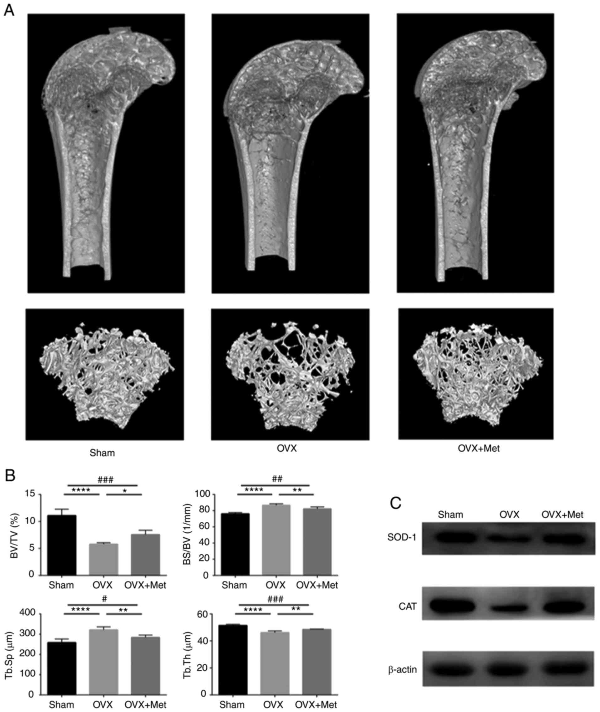 Micro-ct values of OWA (in mm2) (A) and CUR (B) among hominoid living