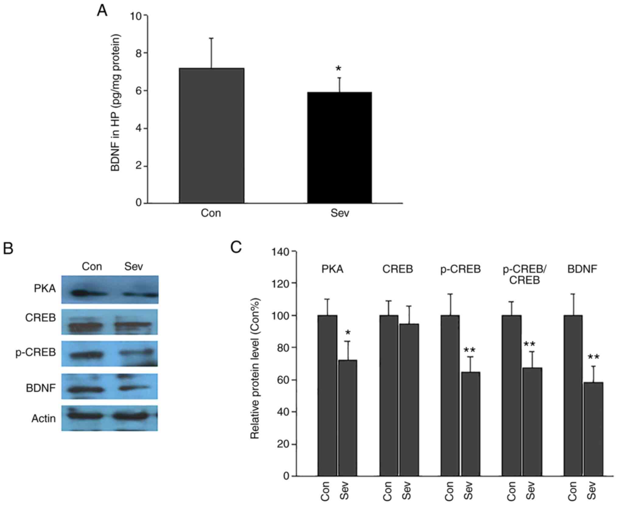 Prolonged exposure to high fluoride levels during adolescence to adulthood  elicits molecular, morphological, and functional impairments in the  hippocampus