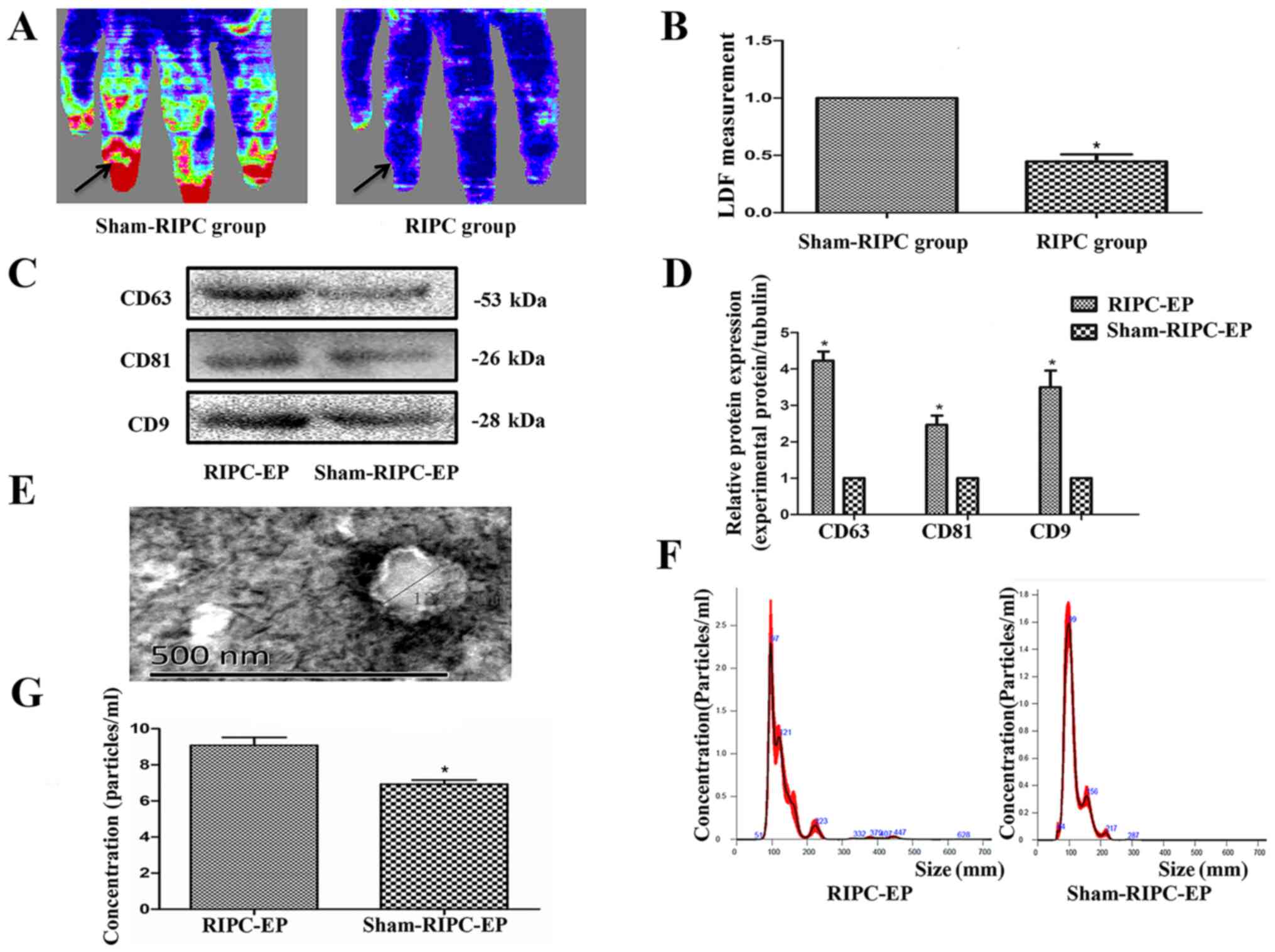 Knockout of miR-144/451 cluster aggravated neurological function and