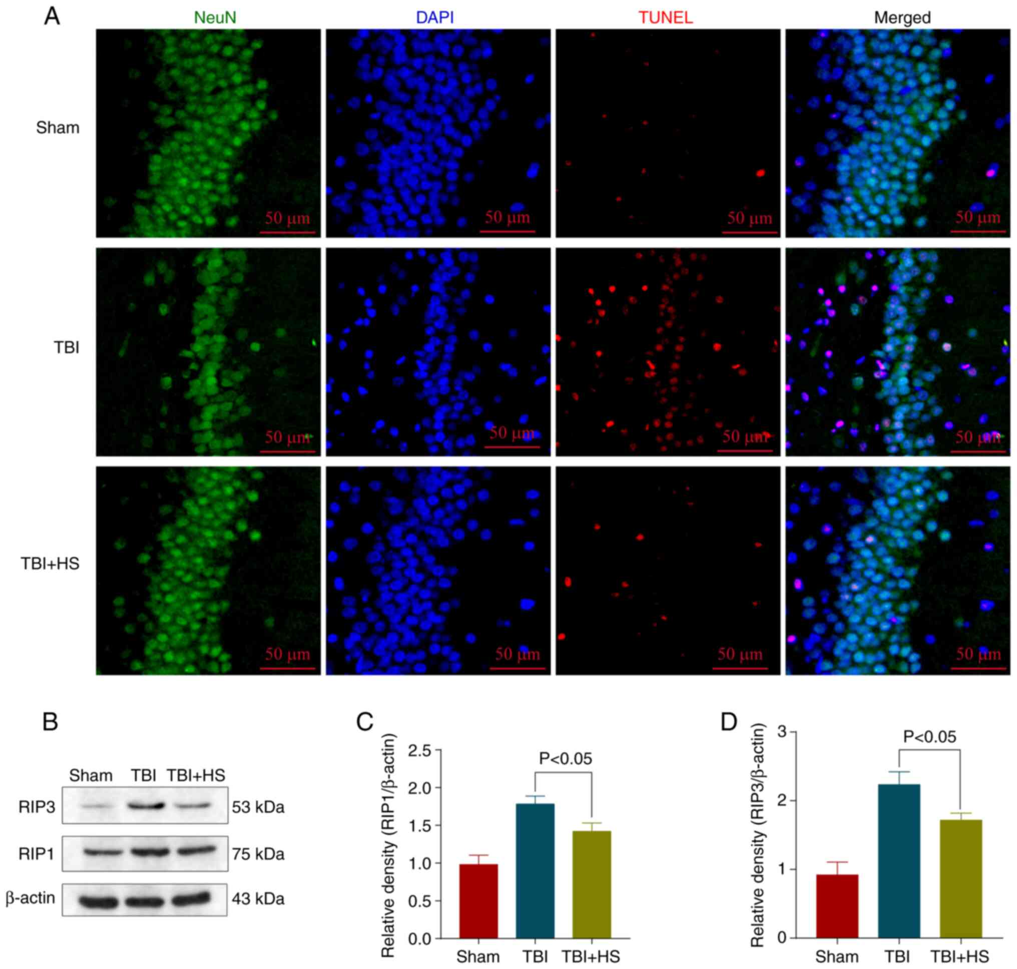 Erythropoietin in traumatic brain injury (EPO-TBI): a double-blind