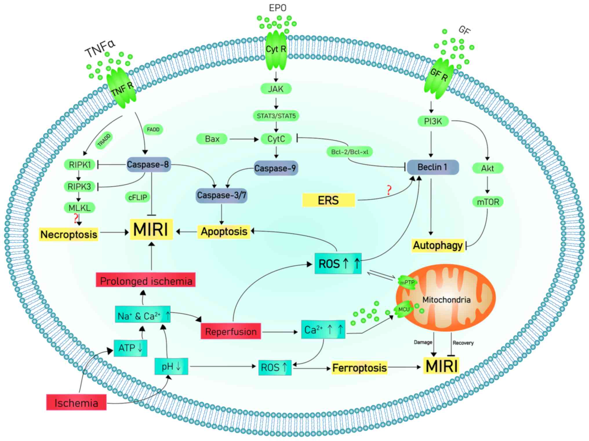 Distinct Roles of Autophagy in the Heart During Ischemia and Reperfusion