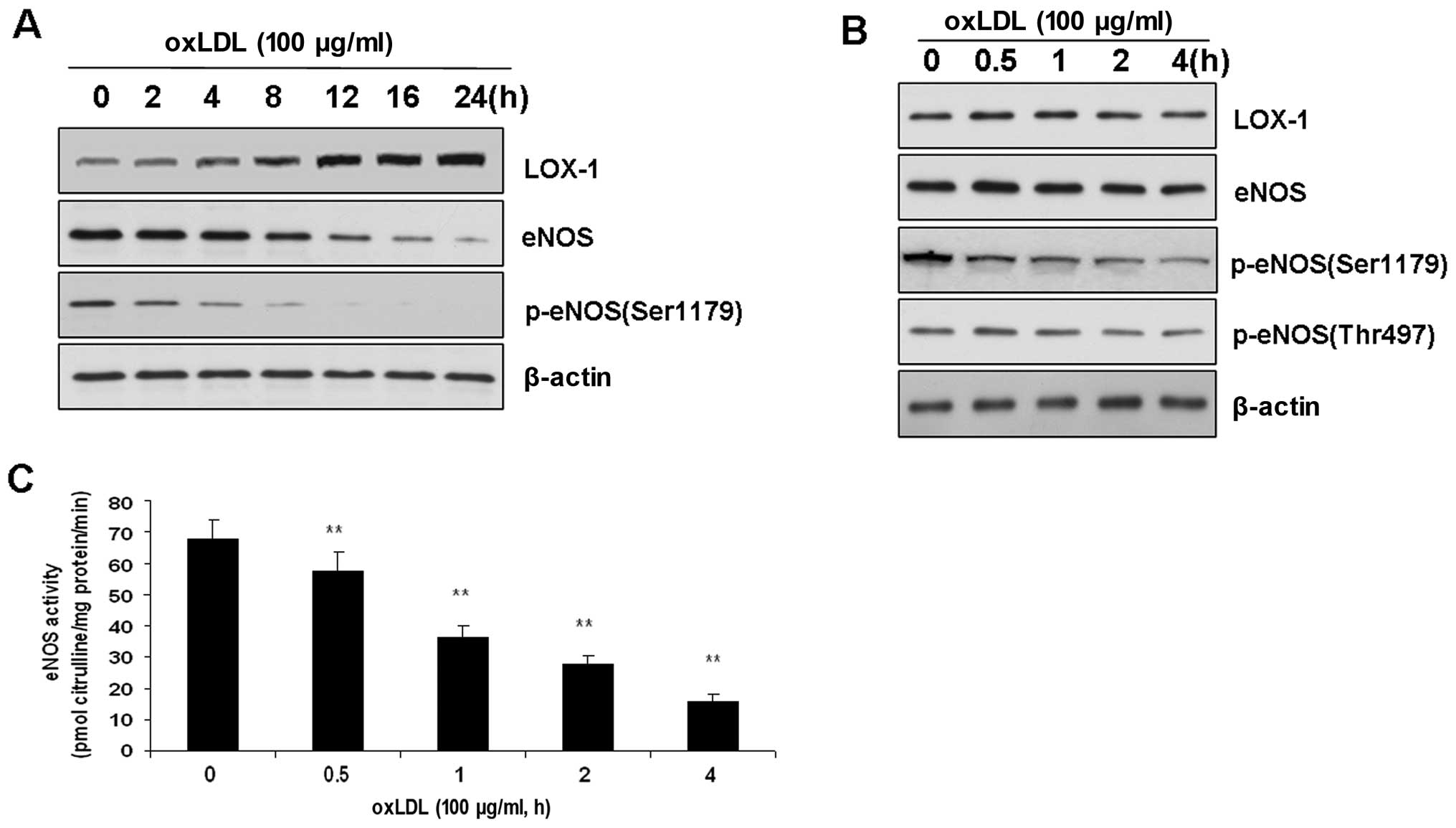 Ox Ldl Downregulates Enos Activity Via Lox 1 Mediated Endoplasmic