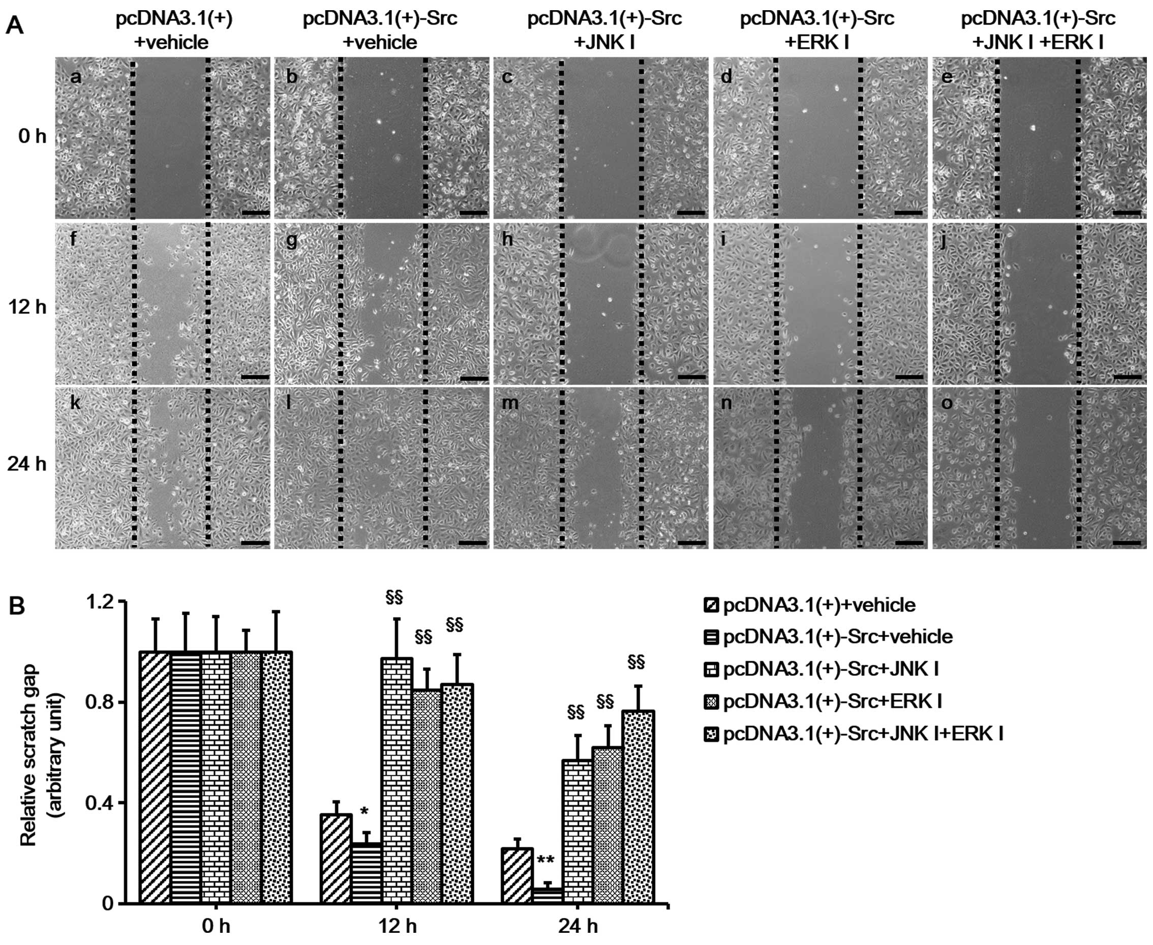 Src Promotes Cutaneous Wound Healing By Regulating Mmp 2