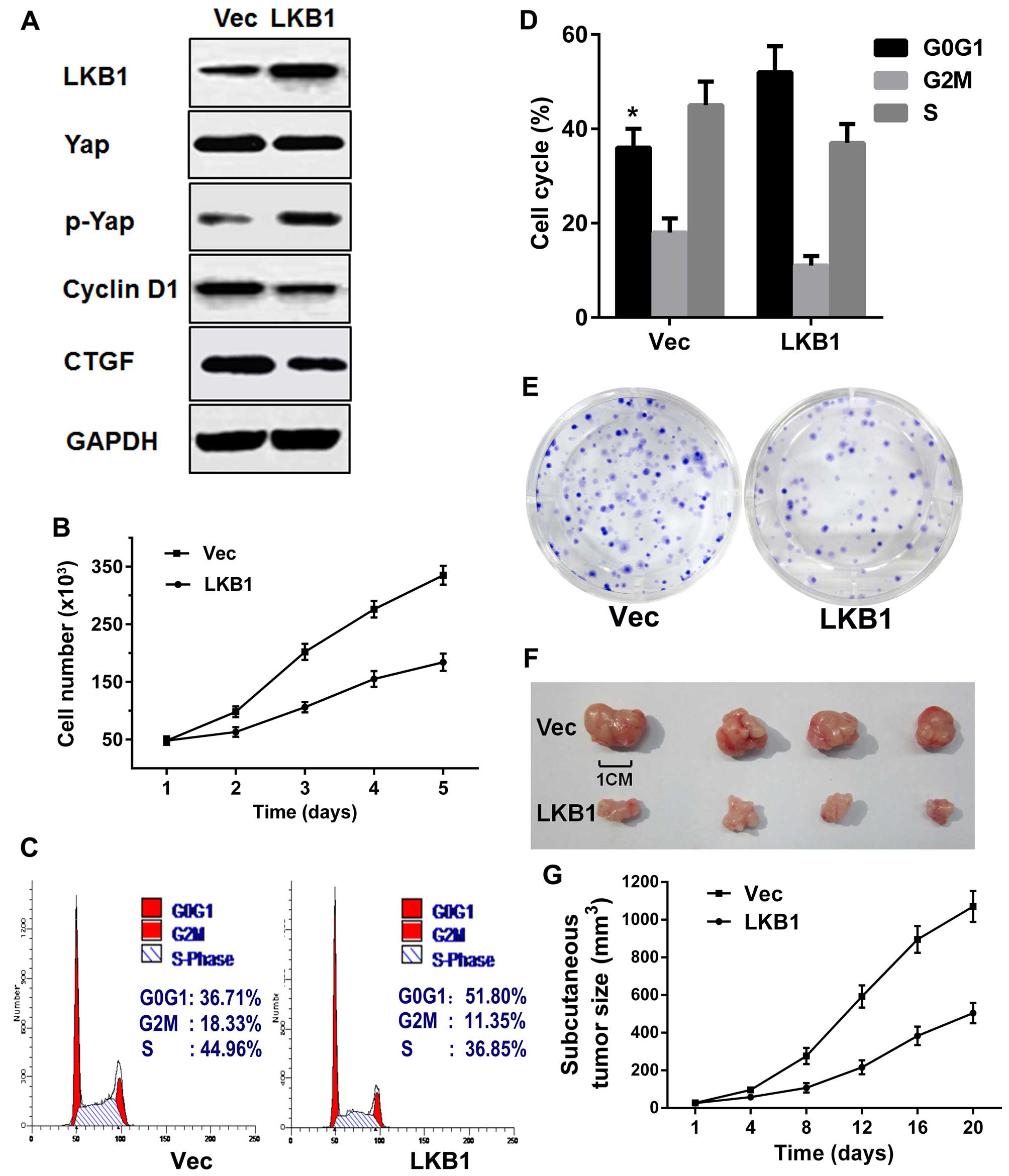 International Journal of Molecular Medicine LKB1 inhibits the proliferation of gastric cancer cells by suppressing the nuclear translocation of Yap and β-catenin