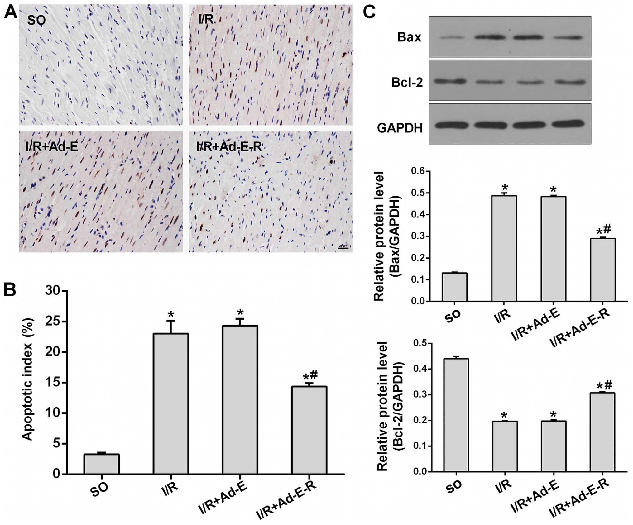 Radioprotective 105 Kda Protein Attenuates Ischemia Reperfusion Induced Myocardial Apoptosis And Autophagy By Inhibiting The Activation Of The Tlr4 Nf Kb Signaling Pathway In Rats