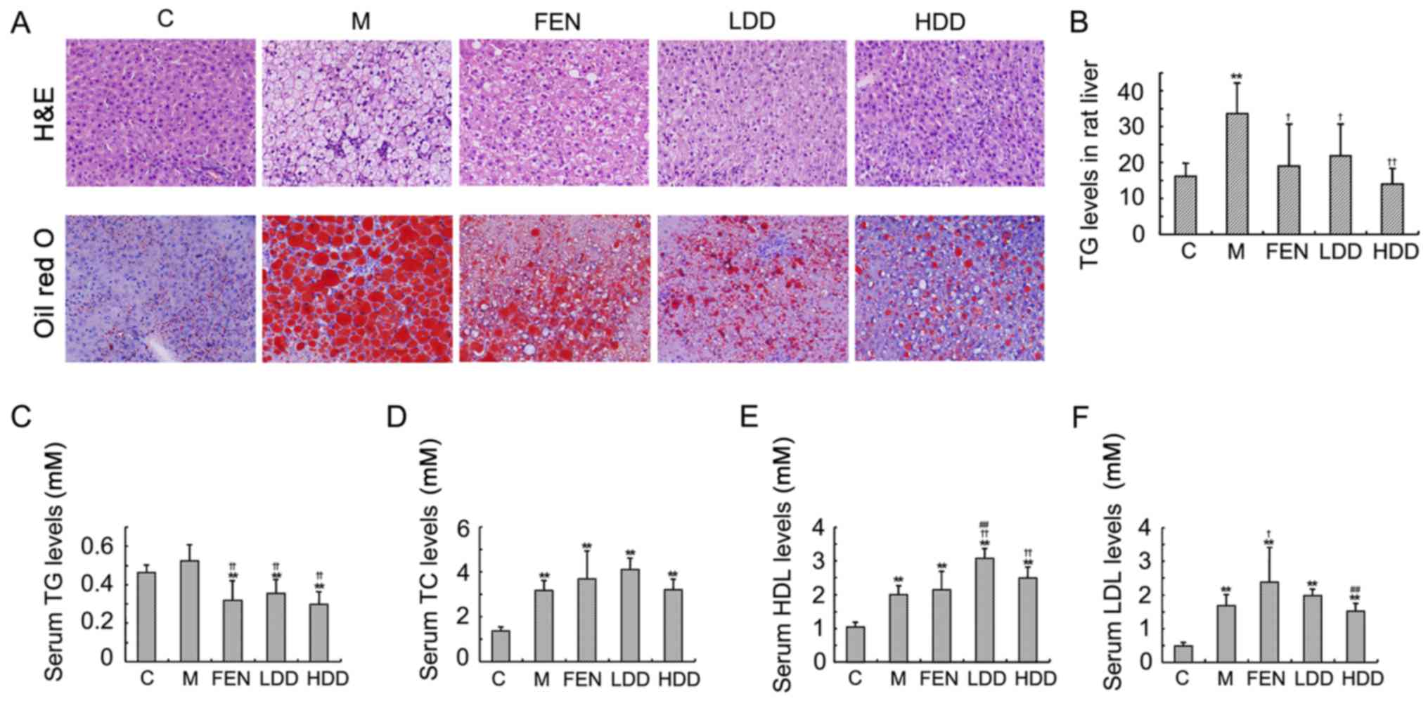 high fat diet liver