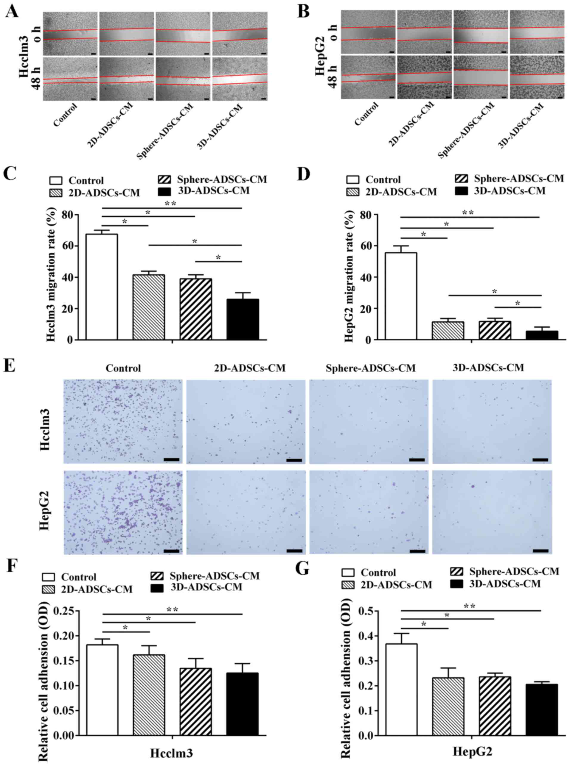 3d Cultured Adipose Tissue Derived Stem Cells Inhibit Liver Cancer Cell Migration And Invasion Through Suppressing Epithelial Mesenchymal Transition