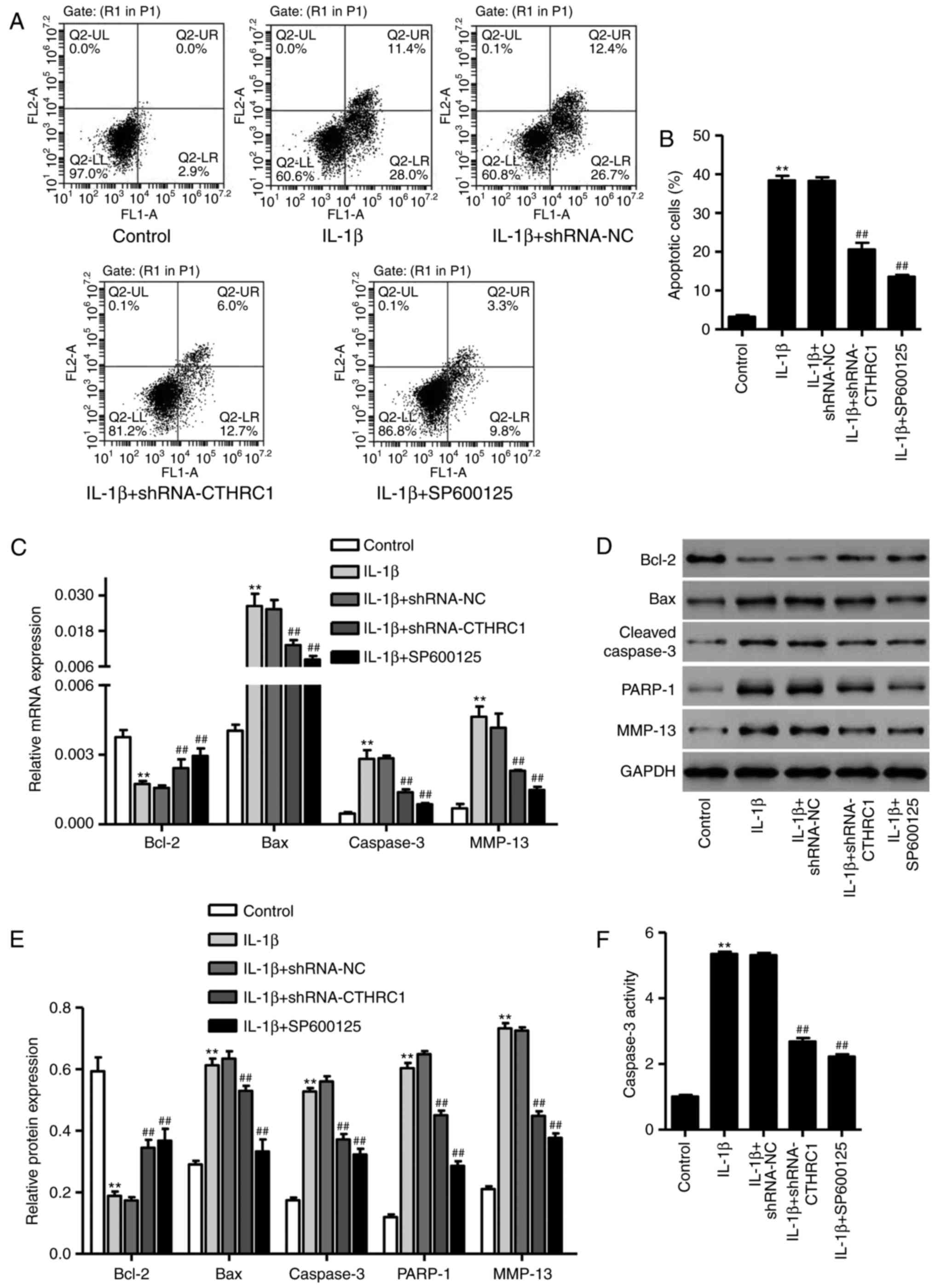 Cthrc1 Mediates Il‑1β‑induced Apoptosis In Chondrocytes Via Jnk1 2 Signaling