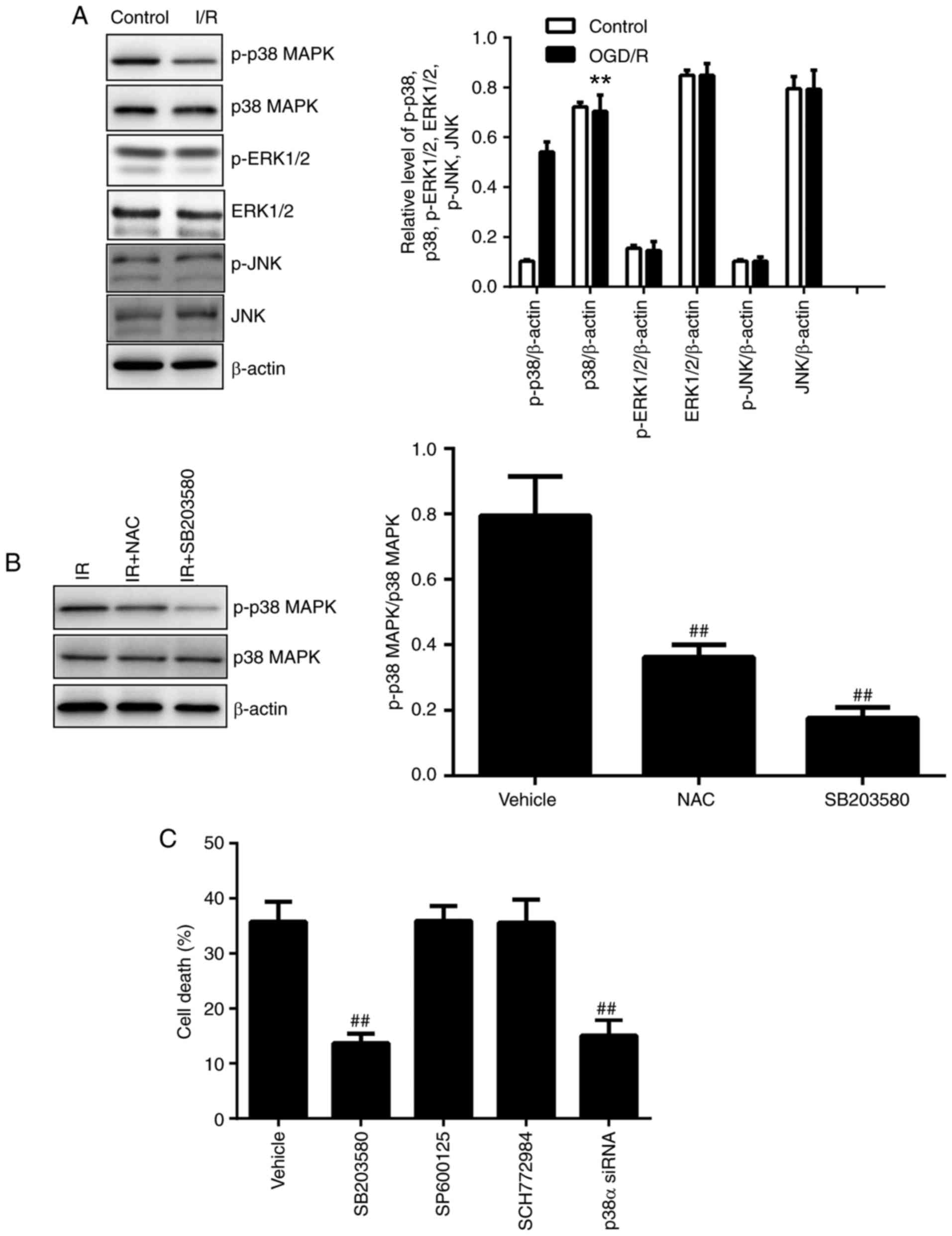 Mitochondrial defects caused by PARL deficiency lead to arrested  spermatogenesis and ferroptosis