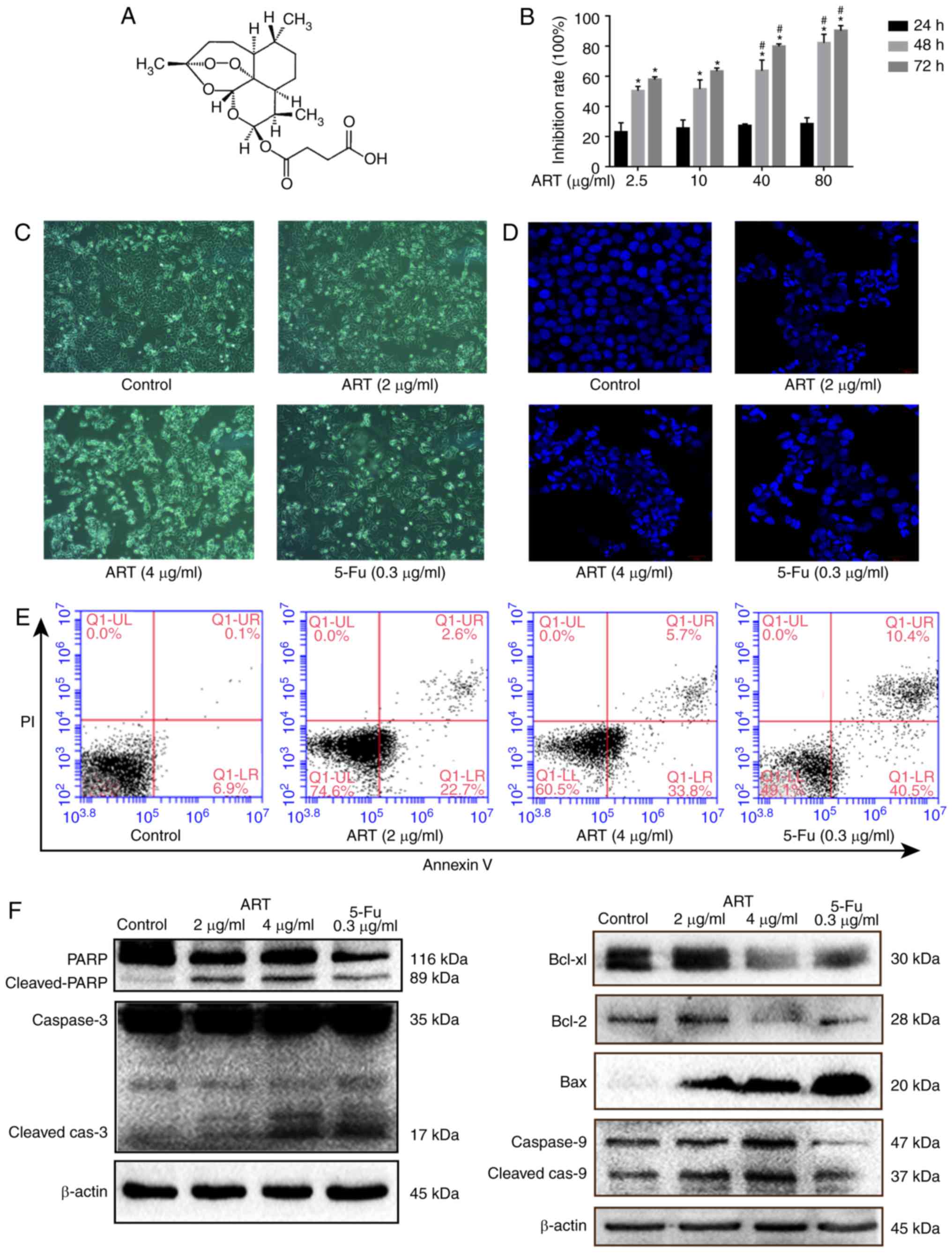 Artesunate induces apoptosis and autophagy in HCT116 colon 