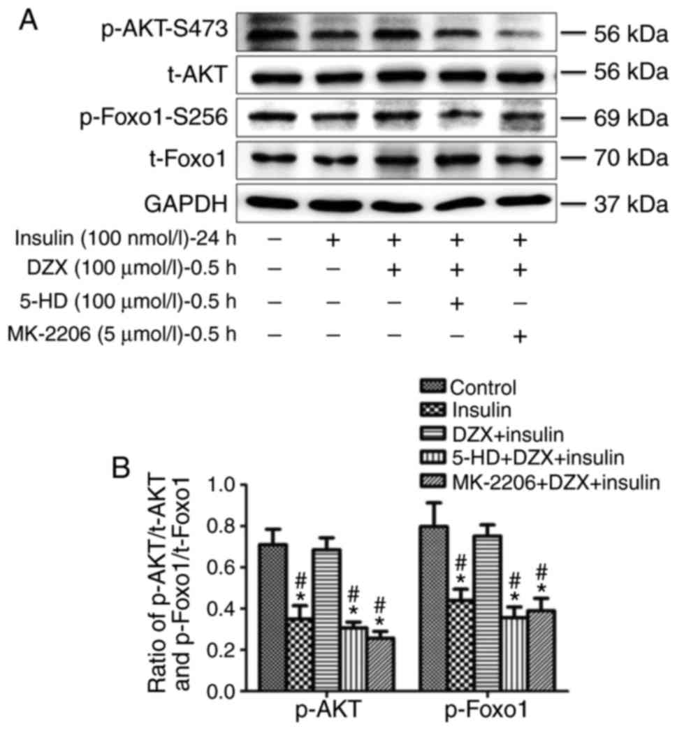 Opening Of Mitokatp Improves Cardiac Function And Inhibits Apoptosis Via The Akt Foxo1 Signaling Pathway In Diabetic Cardiomyopathy