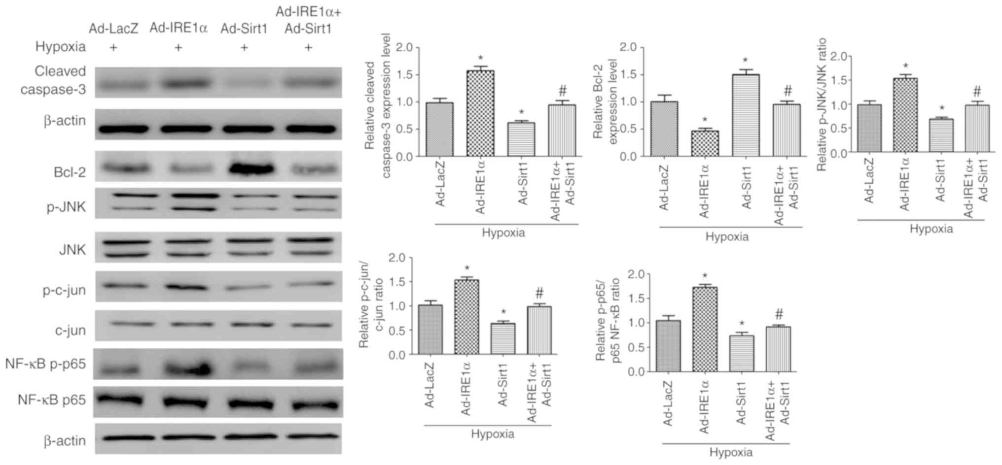Activarea semnalizării factorului nuclear-kappa B promovează senescența celulară