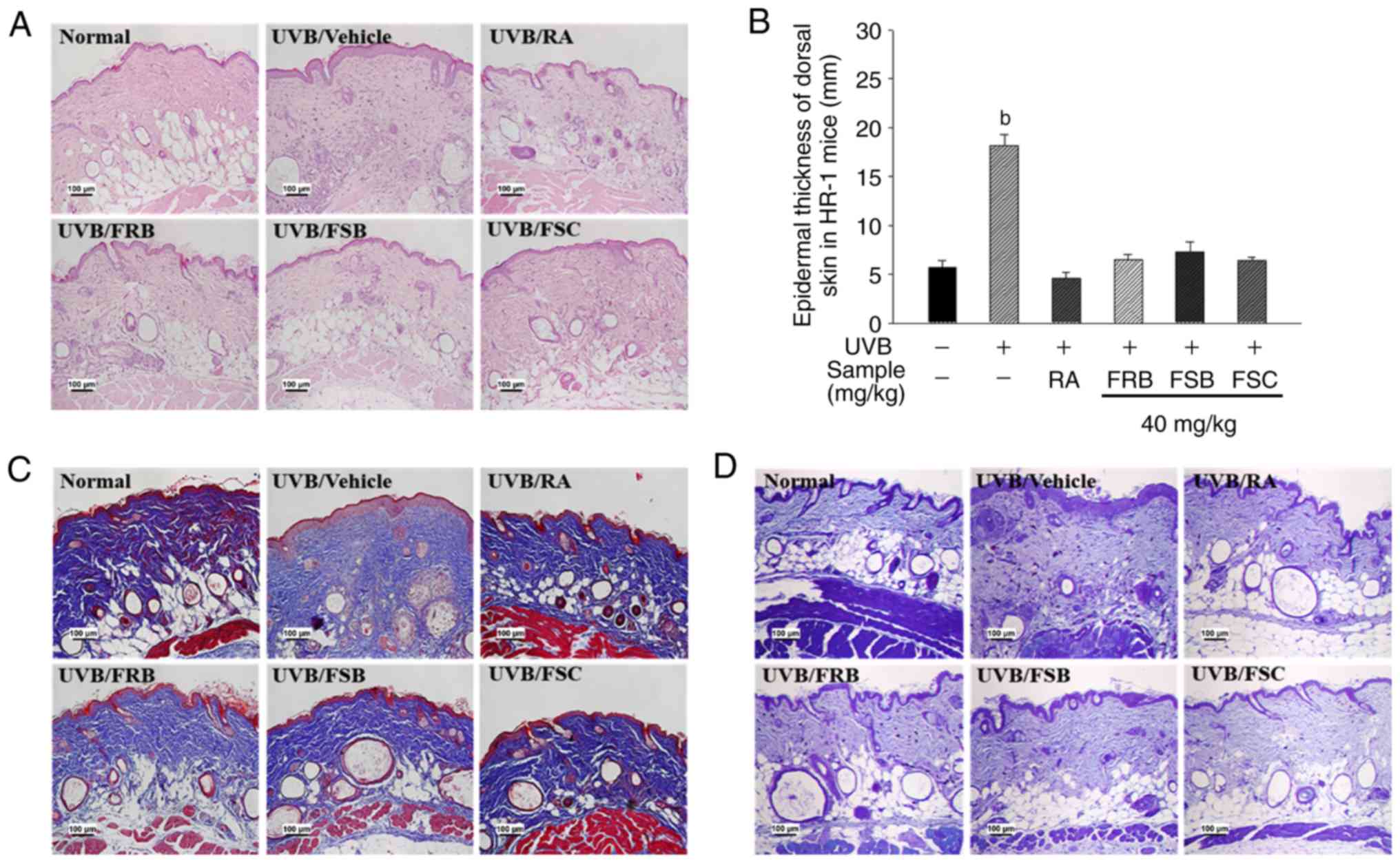 Anti Photoaging Effect Of Fermented Agricultural By Products On Ultraviolet B Irradiated Hairless Mouse Skin
