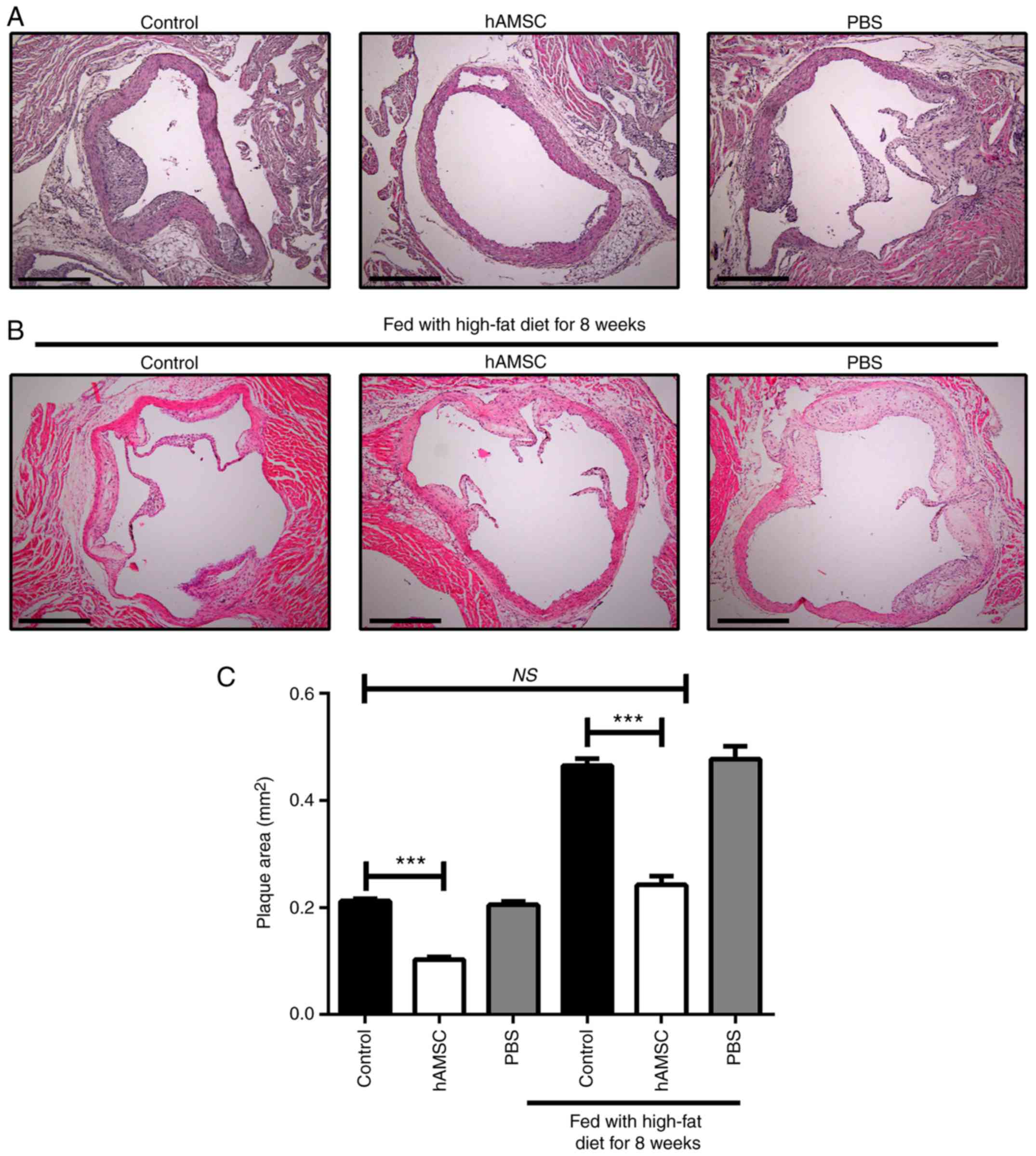 Human Amnion Mesenchymal Stem Cells Attenuate Atherosclerosis By