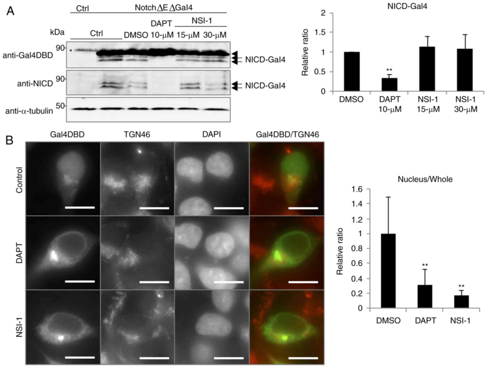 Novel Notch Signaling Inhibitor Nsi 1 Suppresses Nuclear Translocation Of The Notch Intracellular Domain - nsi test 1 roblox