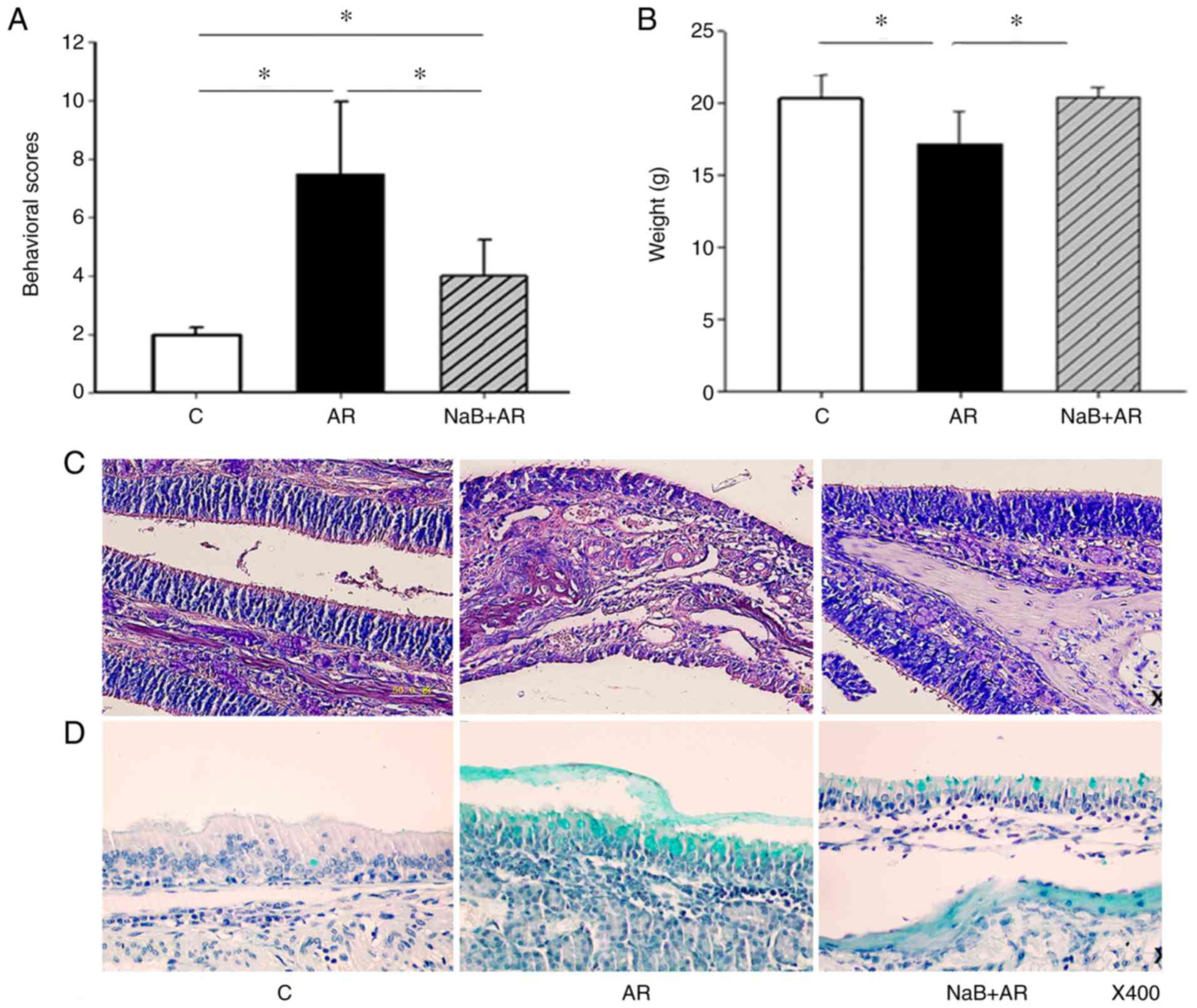 Sodium butyrate alleviates R97-116 peptide-induced myasthenia