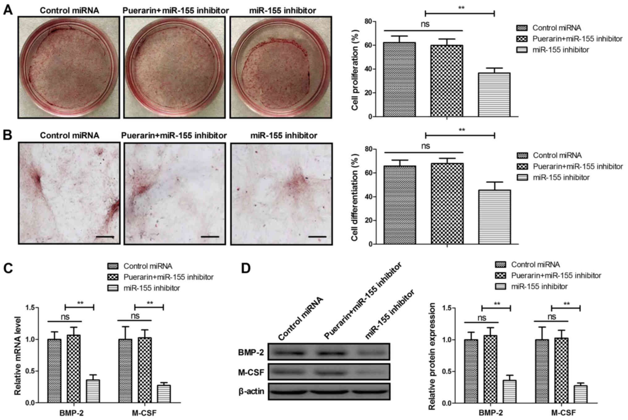 Puerarin Improves Graft Bone Defect Through Microrna 155 3p Mediated P53 Tnf A Stat1 Signaling Pathway