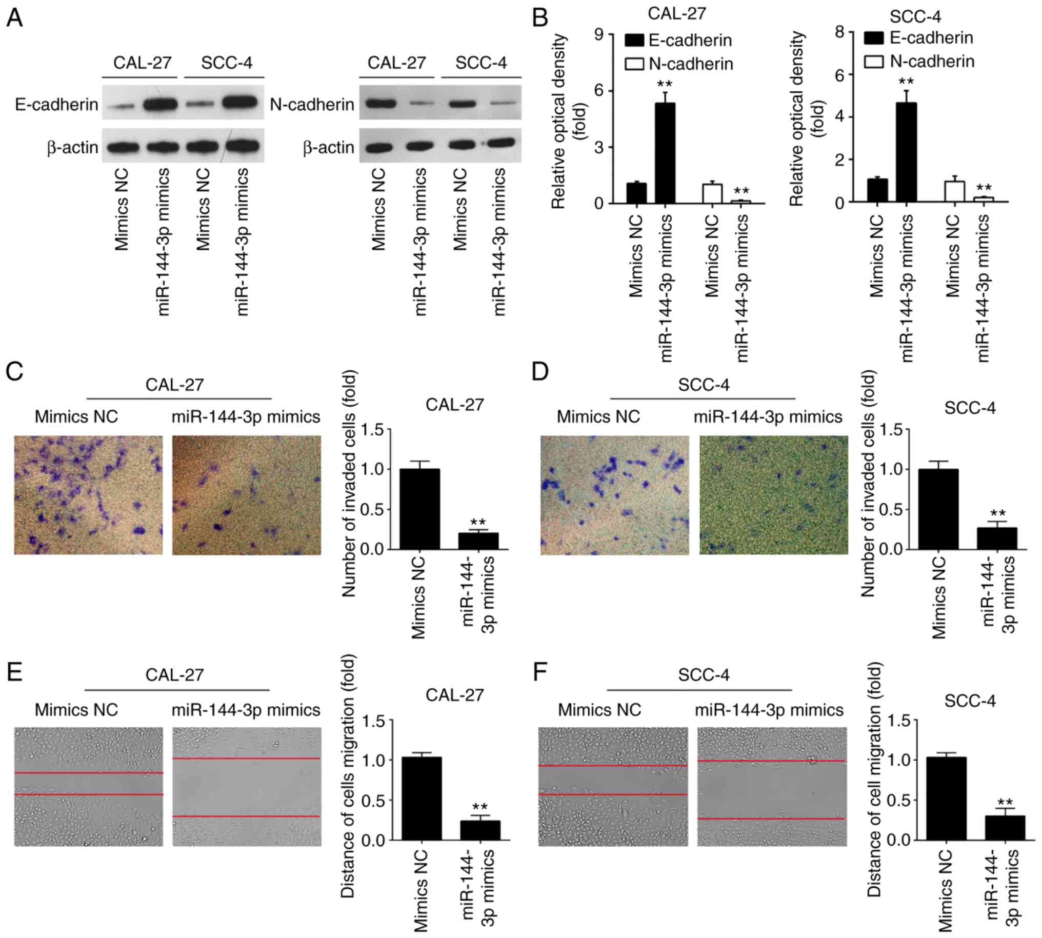 Mir‑144‑3p Inhibits Tumor Cell Growth And Invasion In Oral Squamous