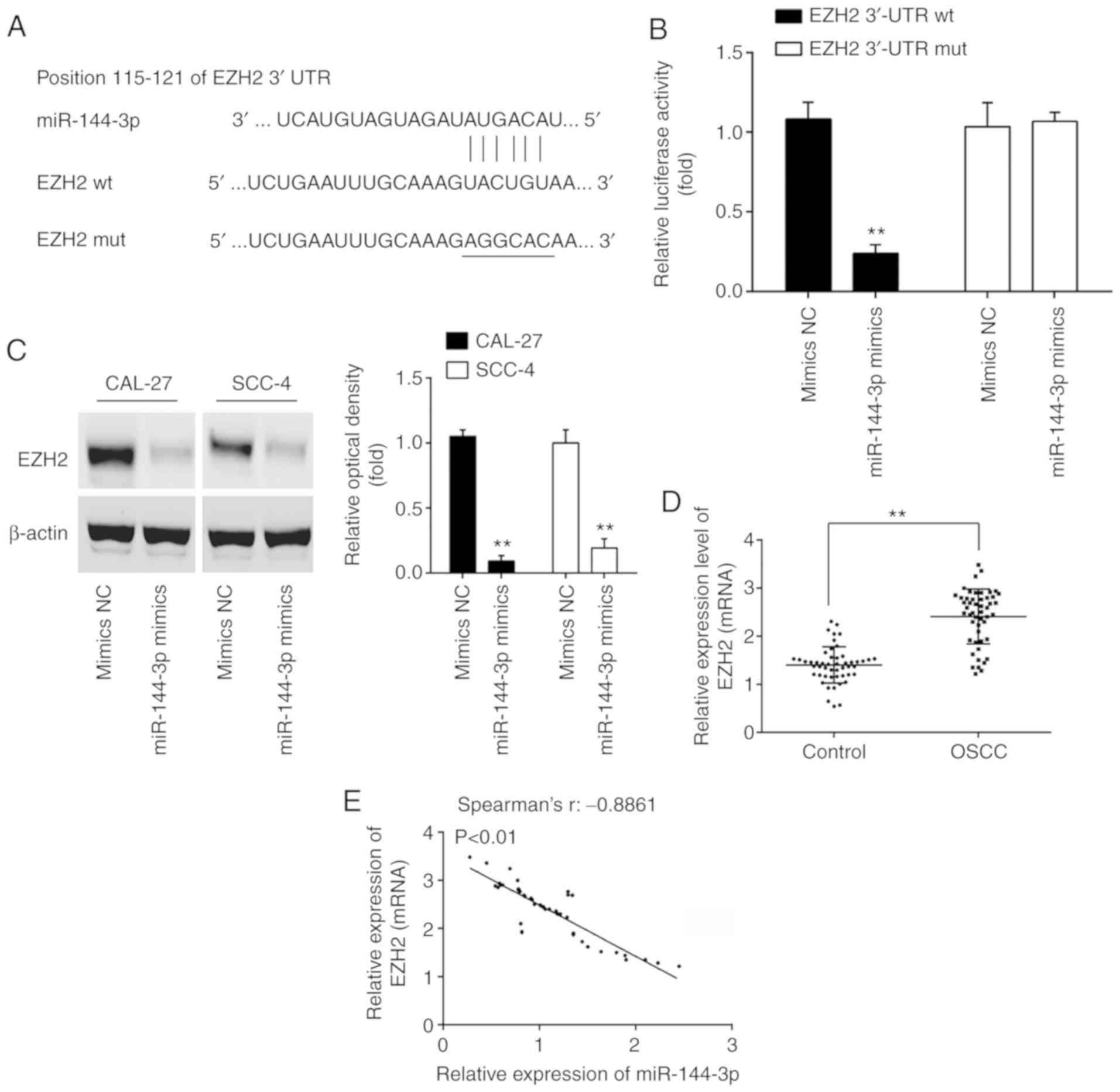 Mir‑144‑3p Inhibits Tumor Cell Growth And Invasion In Oral Squamous Cell Carcinoma Through The