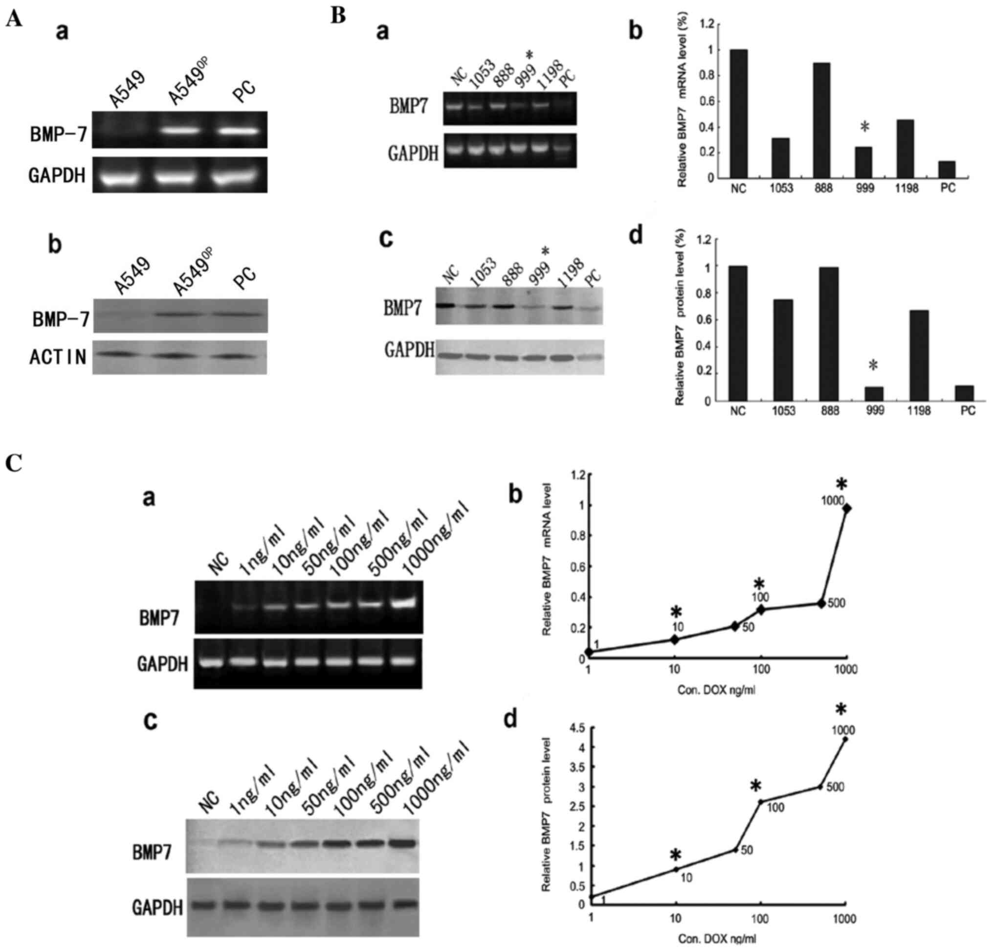 Reduced and induced expression and
overexpression of BMP7 protein in lung cancer cells. (A) A549 cells
transfected with BMP7 plasmid (A549OP cells) expressed BMP7 as
shown using the RT-PCR method (Aa and b) and western blot analysis
(PC, positive control). Expression status of BMP7 transcripts in
SPC-A1 cells through shRNA-mediated depletion of BMP7 mRNA was
strongly decreased for shRNA target 999 when compared with the
other targets (1053, 888, 1198). (Ba and c) shRNA designed for four
different targets could reduce BMP7 expression in SPC-A1 cell using
RT-PCR and western blot analysis. (Bb and d) Normalised band
volumes of BMP7 expression in SPC-A1 cells. (C) Induced expression
levels of BMP7 in pulmonary tumour cell lines by RT-PCR and western
blot analysis using GAPDH expression as the control. Three DOX
concentrations were chosen for the induction model (10, 100 and
1,000 ng/ml).
