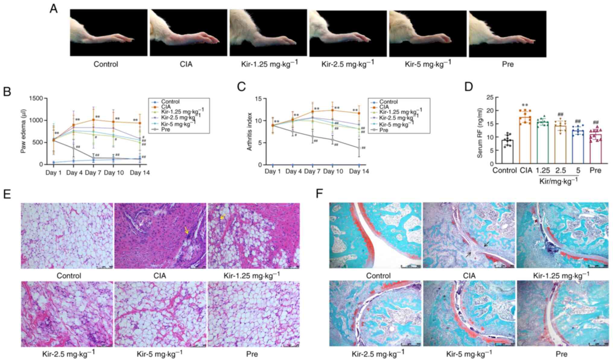 Ameliorative effects of Kir on
rheumatoid arthritis in CIA rats. (A) Foot swelling of the rats in
each group after Kir intervention. (B) Paw edema of the rats in
each group. (C) AI of the rats in each group. (D) RF levels in the
serum of the rats in each group. (E) Histopathological changes in
the synovial tissue in the rat joints (H&E staining;
magnification, ×200); the white arrows indicate vascular dilation
and congestion and the yellow arrows indicate inflammatory cell
infiltration. (F) Histopathological changes of the cartilage tissue
in the rat joints (safranin-O/fast staining; magnification, ×50);
cartilage tissue is stained in red and bone tissue in green; black
arrows indicate the invasion of synovial tissue and articular
cartilage destruction. All data are expressed as the mean ± SD
(n=10). Kruskal-Wallis followed by Dunn's post-test was performed
in C, one-way ANOVA followed by Tukey test was performed in D and
one-way ANOVA followed by Games-Howell method in B.
**P<0.01 vs. the control group;
#P<0.05, ##P<0.01 vs. the CIA group.
Kir, Kirenol; CIA, collagen-induced arthritis; AI, arthritis index;
RF, rheumatoid factor; H&E, hematoxylin and eosin; Pre,
prednisone.