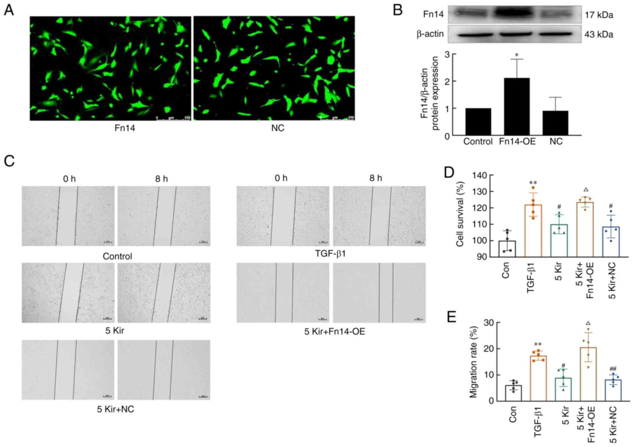 Fn14 overexpression abolishes the
effect of Kir on the proliferation and migration of TGF-β1-induced
MH7A cells. (A) The GFP expression in MH7A cells transfected with
the lentivirus (magnification, ×200). (B) The Fn14 protein levels
in MH7A cells transfected with Fn14-OE compared with NC lentivirus;
β-actin was used as normalization control; (n=3)
*P<0.05 vs. NC group. (D) Effect of Kir on the
proliferation of Fn14-overexpressing MH7A cells. (C and E) Effect
of Kir on the migratory ability of Fn14-overexpressing MH7A cells
(magnification, ×50); (n=5). One-way ANOVA followed by LSD was
performed in B, one-way ANOVA followed by Tukey test was performed
in D and one-way ANOVA followed by Games-Howell was performed in F.
**P<0.01 vs. the control group, #P<0.05
or ##P<0.01 vs. the TGF-β1 group,
△P<0.05 vs. the 5 µM Kir group. All the data
are expressed as the mean ± SD. Kir, Kirenol; TGF-β1, transforming
growth factor-β1. Kir, Kirenol; Fn14, fibroblast growth
factor-inducible immediate-early response protein 14; Fn14-OE,
Fn14-overexpressing lentivirus; NC, negative control; Con,
control.