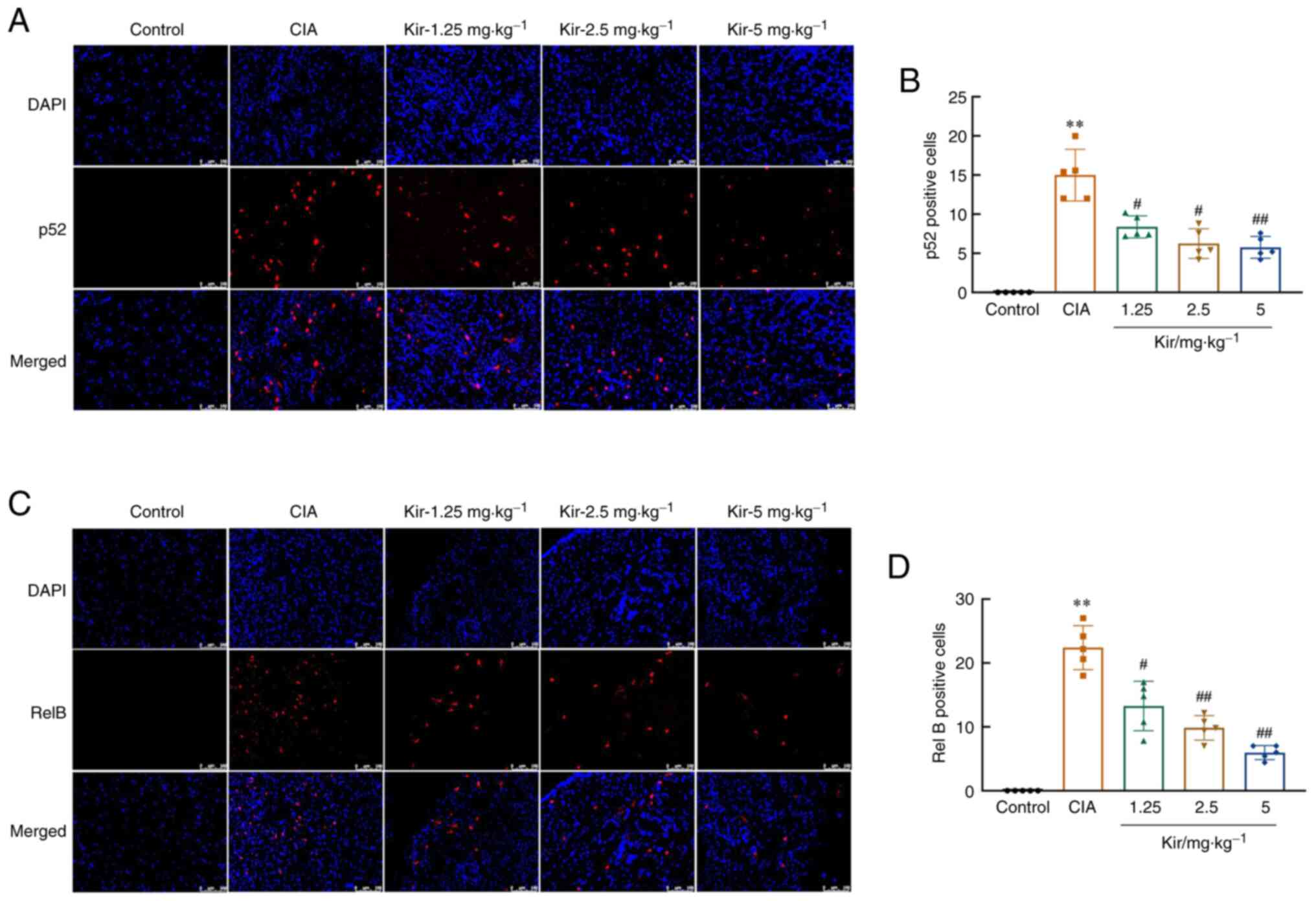Kir reduces nuclear localization of
p52 and RelB in the synovial tissues of CIA rats. (A)
Representative images of immunofluorescence staining for p52
protein in the nucleus (magnification, ×200). (B) Quantitative
analysis of nuclear p52 protein. (C) Representative images of
immunofluorescence staining for RelB proteins in the nucleus
(magnification, ×200); (D) Quantitative analysis of nuclear RelB
protein. All the data are expressed as the mean ± SD (n=5). One-way
ANOVA with Games-Howell method was performed for all analyses.
**P<0.01 vs. the control group, #P<0.05
or ##P<0.01 vs. the CIA group. Kir, kirenol; CIA,
collagen-induced arthritis; PCNA, proliferating cell nuclear
antigen.