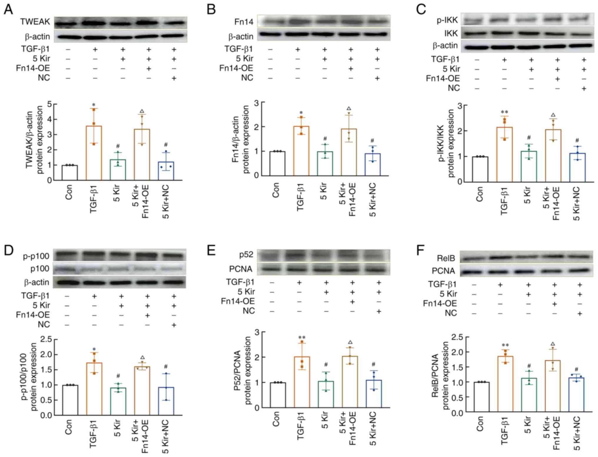 Fn14 overexpression blocks the effect
of Kir on TWEAK/Fn14 pathway-related proteins in TGF-β1-induced
MH7A cells. Representative images and quantification of western
blot results showing the protein expression of (A) TWEAK (B) and
Fn14, and the phosphorylation of (C) IKKα and (D) p100. β-actin was
used as the loading control. Representative images and
quantification of western blot results for the nuclear proteins (E)
p52 and (F) RelB. PCNA was used as the loading control for
nucleoprotein. All the data are expressed as the mean ± SD (n=3).
One-way ANOVA followed by Tukey test was performed in all analyses.
*P<0.05 or **P<0.01 vs. the control
group, #P<0.05 vs. the TGF-β1 group,
△P<0.05 vs. the 5 µM Kir group. Kir, kirenol;
TGF-β1, transforming growth factor-β1; PCNA, proliferating cell
nuclear antigen; TWEAK, tumor necrosis factor-like weak inducer of
apoptosis; Fn14, fibroblast growth factor-inducible immediate-early
response protein 14; PCNA, proliferating cell nuclear antigen.