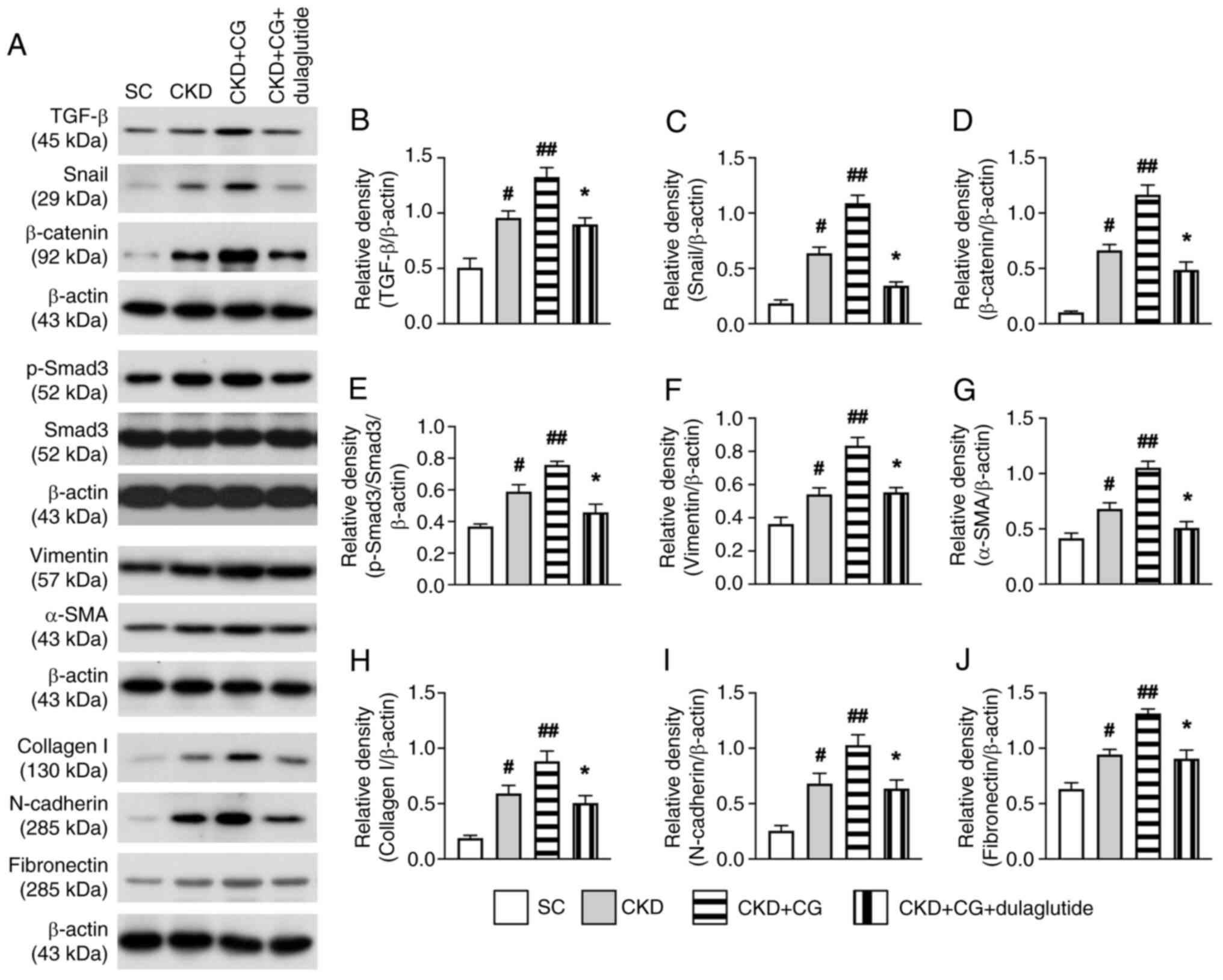 Protein expression levels of
epithelial-mesenchymal transistion biomarkers in the peritonium by
day 42 after CKD induction. (A) Protein expression levels were
detected by western blot analysis. Semi-quantification of (B)
TGF-β, (C) Snail, (D) β-catenin, (E) p-Smad3/Smad3, (F) vimentin,
(G) α-SMA, (H) collagen I, (I) N-cadherin and (J) fibronectin. All
statistical analyses were performed by one-way ANOVA, followed by
Bonferroni's multiple comparisons post hoc test (n=6/group).
#P<0.05, ##P<0.01 vs. SC;
*P<0.05 vs. CKD. α-SMA, α-smooth actin, CKD, chronic
kidney disease; CG, chlorhexidine gluconate; p-, phosphorylated;
SC, sham control.